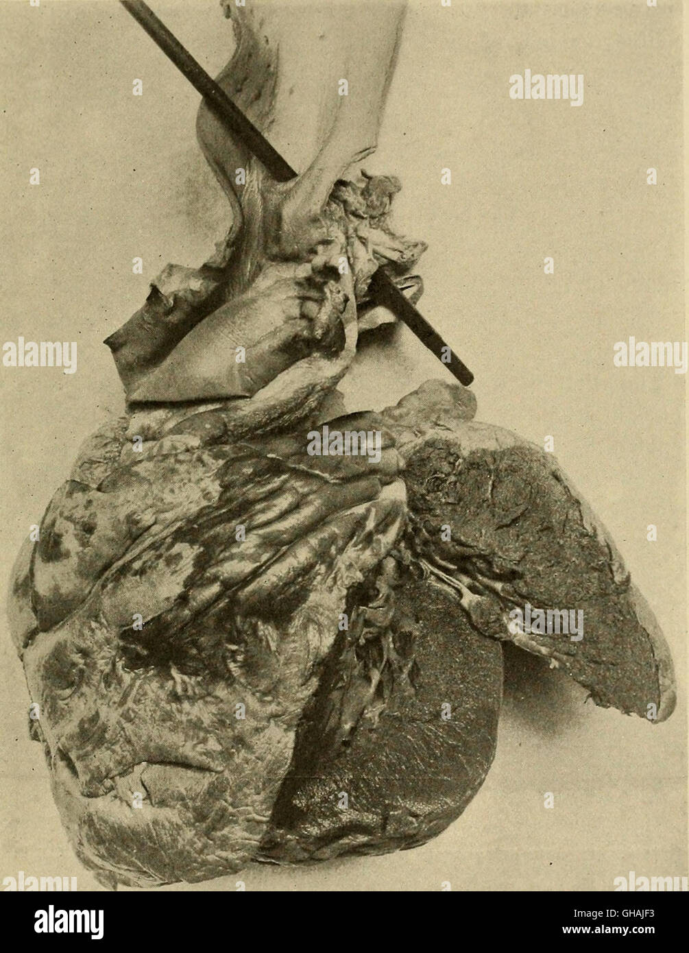 Les maladies du cœur et du système artériel ; conçu pour être une présentation de l'objet à l'usage des étudiants et praticiens de médecine (1910) Banque D'Images