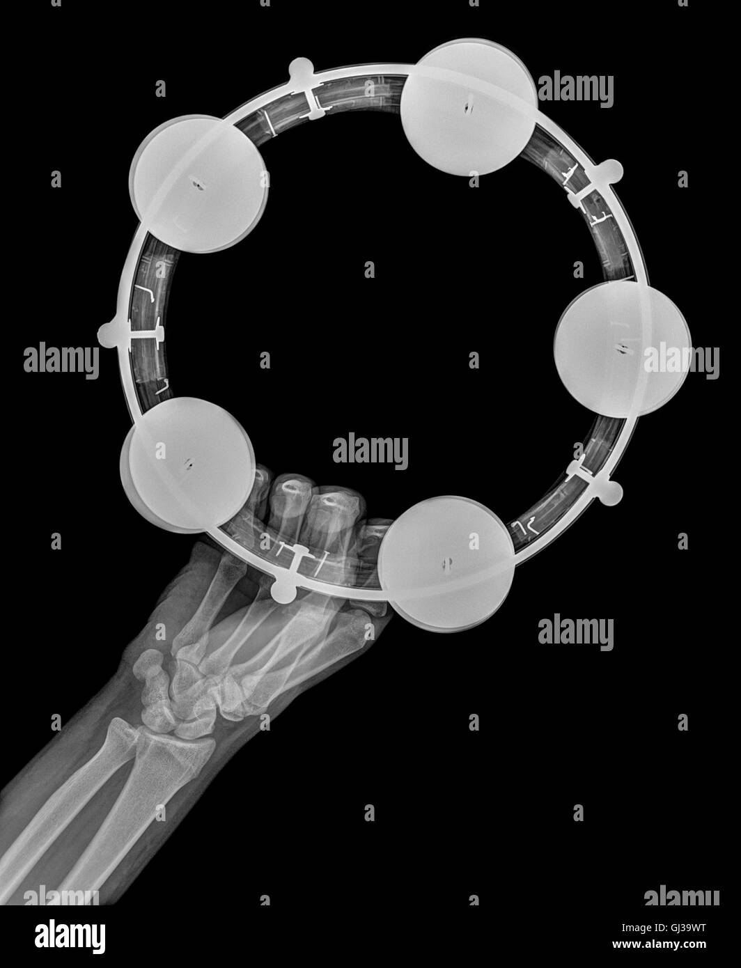 X-ray d'une main tenant un tambourin Banque D'Images