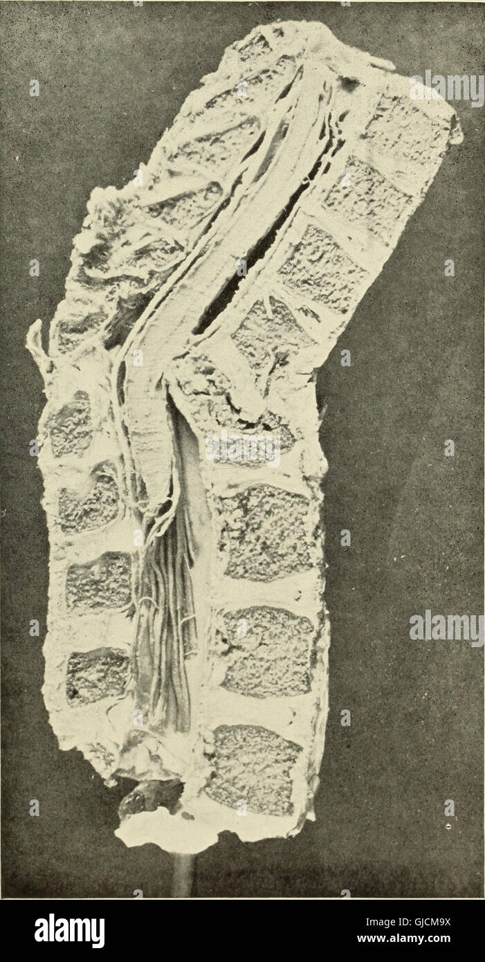 Une publication de 1910 détaillant diverses études et découvertes du Warren Anatomical Museum. Il comprend la recherche en anatomie, en sciences médicales, et des sujets connexes. Banque D'Images