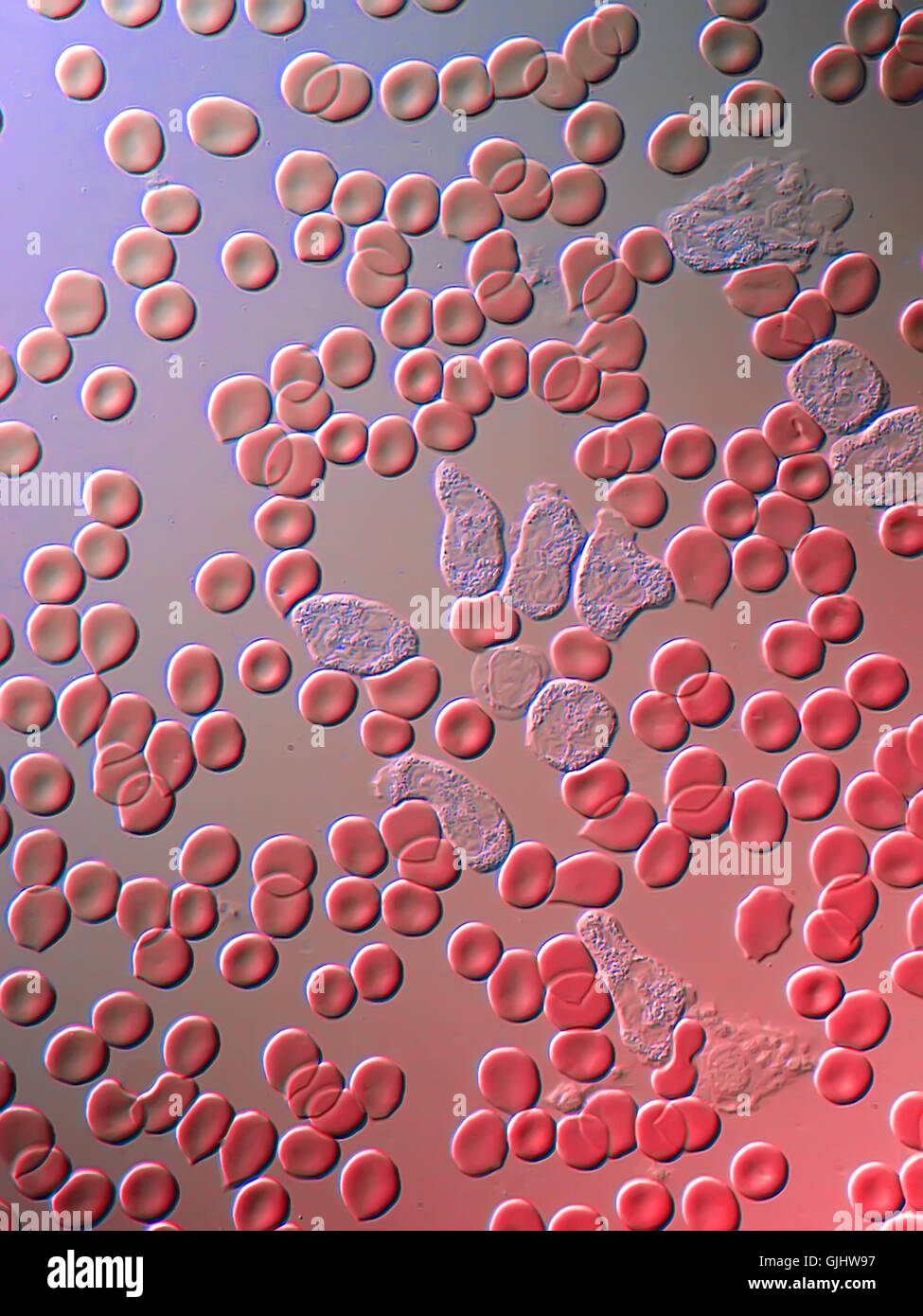 La transfusion sanguine médecin Banque D'Images