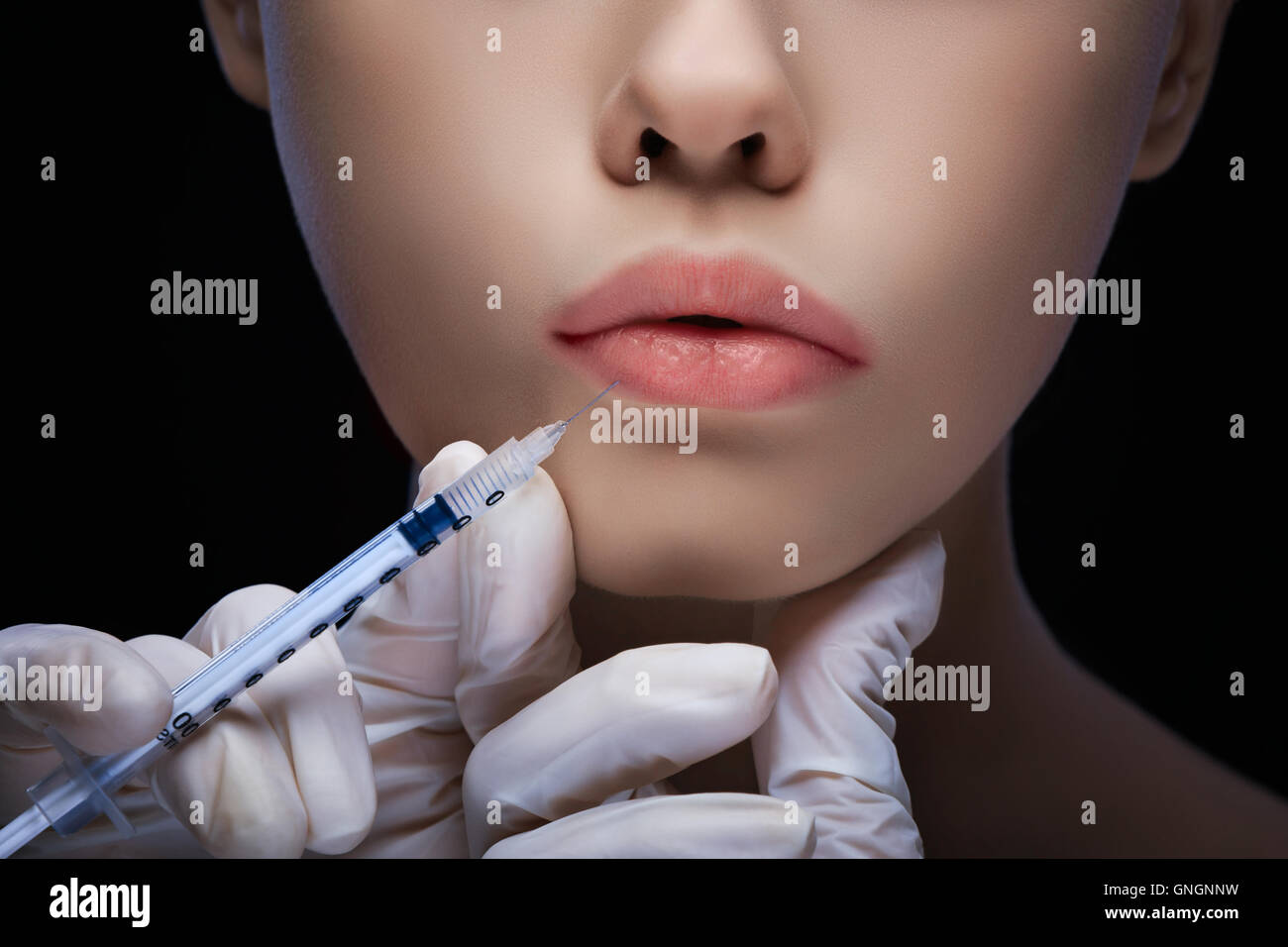 Détail de la vue en gros plan d'une injection de lèvre Banque D'Images