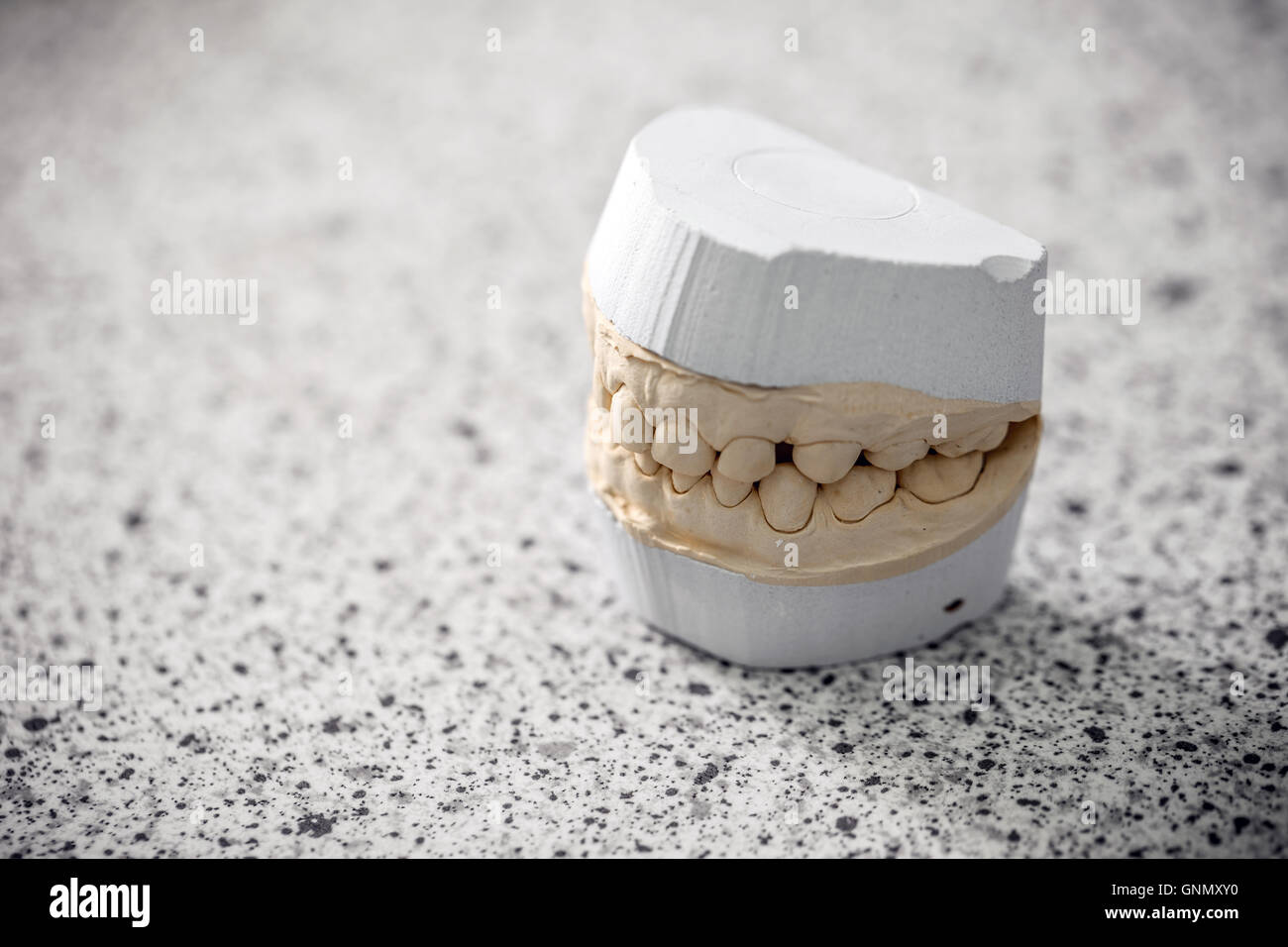 Modèle de la dent en plâtre de gypse Banque D'Images