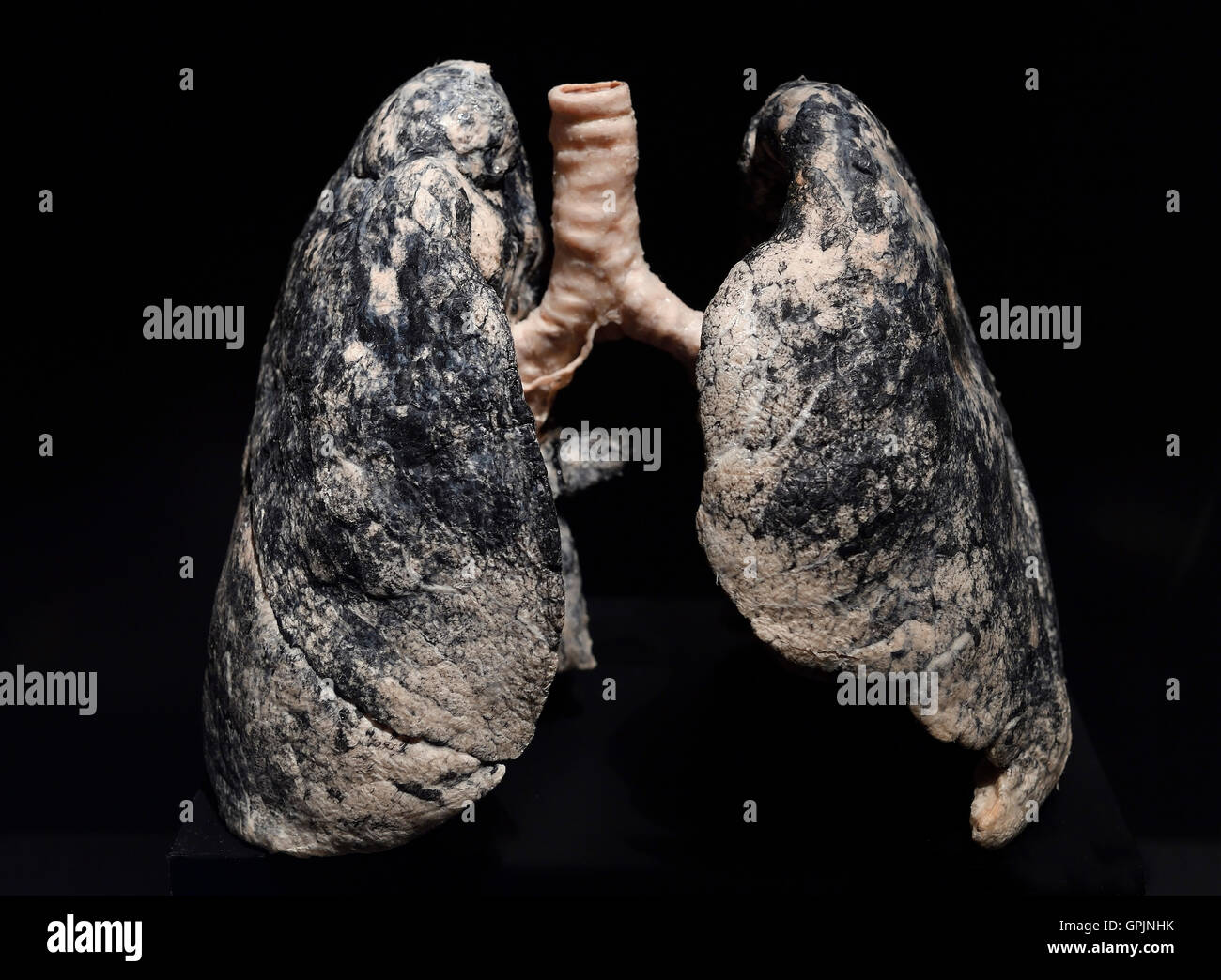 Plastinate, poumons humains, fumeur, Le Monde du corps, Menschen Museum, Berlin, Allemagne Banque D'Images