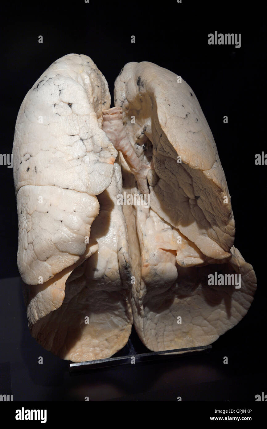 Plastinate, poumon humain en bonne santé, le monde du corps, Menschen Museum, Berlin, Allemagne Banque D'Images