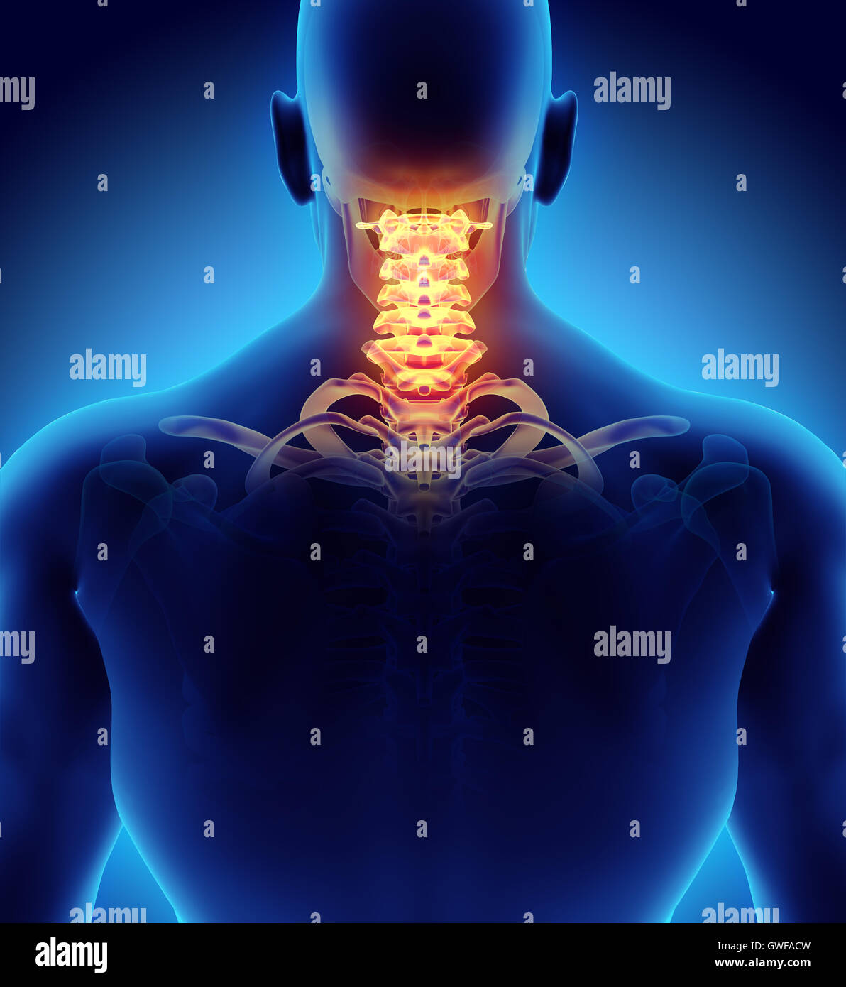 3D illustration de rachis cervical - Partie de squelette humain Photo ...