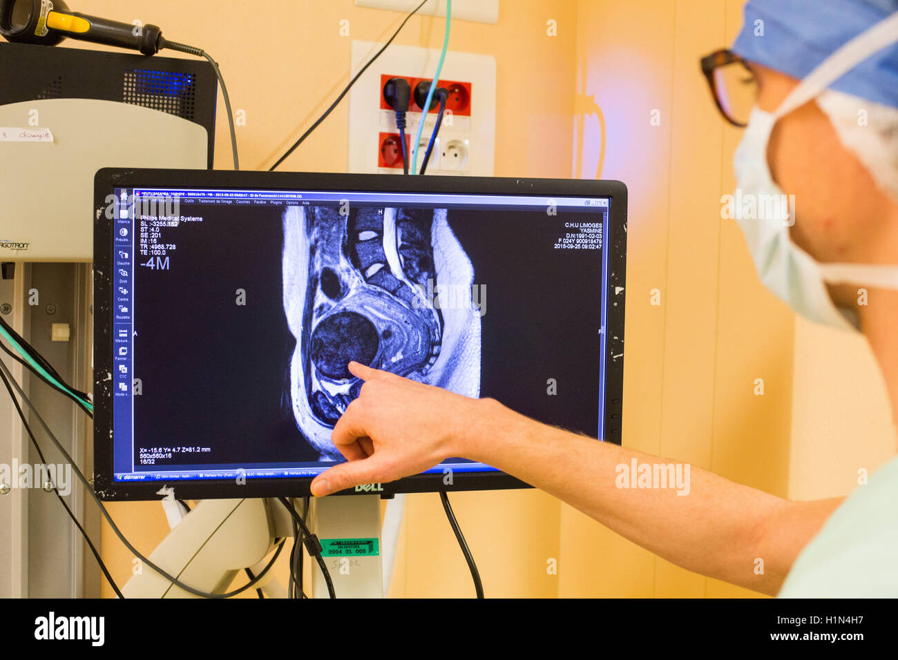 Fibrome utérin effectuée par le robot da Vinci de la téléchirurgie, dont quatre bras articulés et appareil photo sont contrôlés à distance par les chirurgiens de l'hôpital, Limoges, France. Banque D'Images