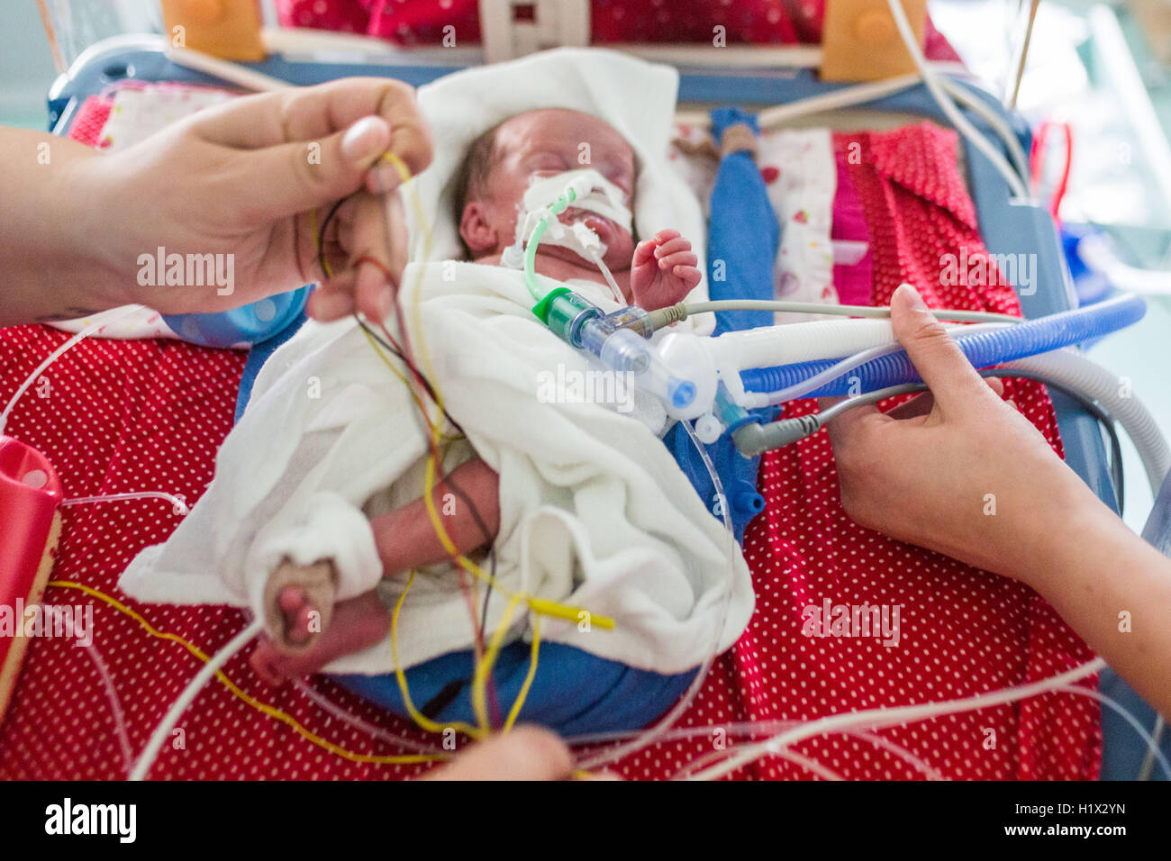 Bébé nouveau-né prématuré placé sous assistance respiratoire, service de pédiatrie, Hôpital de Bordeaux, France. Banque D'Images