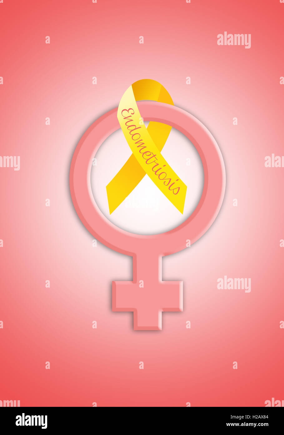 Ruban jaune avec symbole féminin de l'endométriose Photo Stock - Alamy