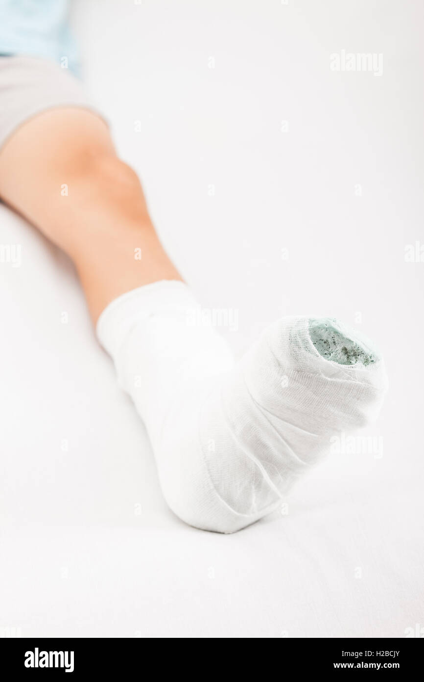 Petit enfant garçon avec bandage en plâtre sur le talon de la jambe  fracture ou br Photo Stock - Alamy
