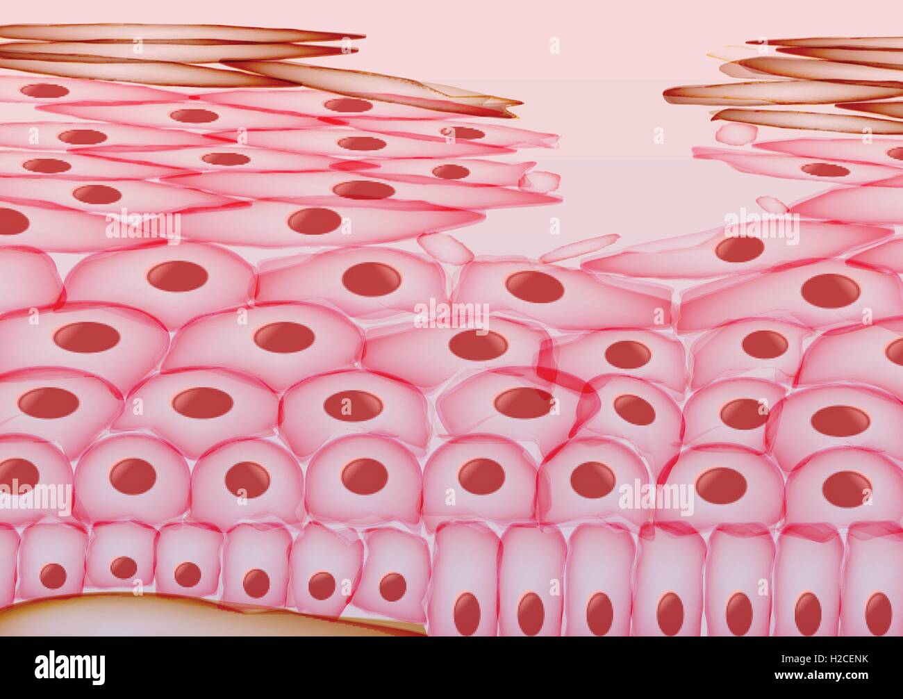 Les dommages aux cellules de la peau, les couches Illustration de Vecteur