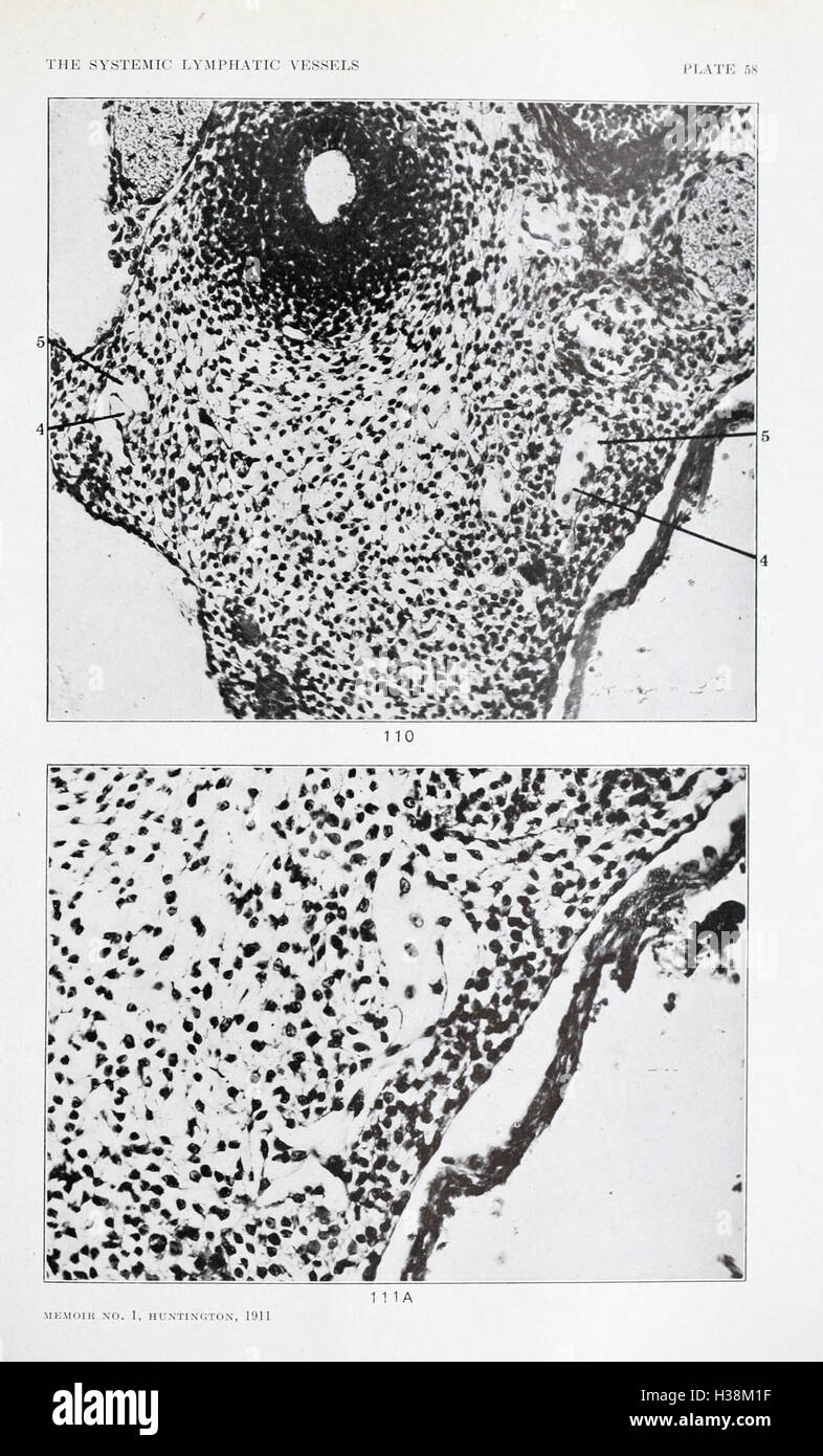 Cette étude examine l'anatomie et le développement du système lymphatique chez les chats domestiques, en se concentrant sur la structure et la fonction des vaisseaux lymphatiques systémiques. Banque D'Images