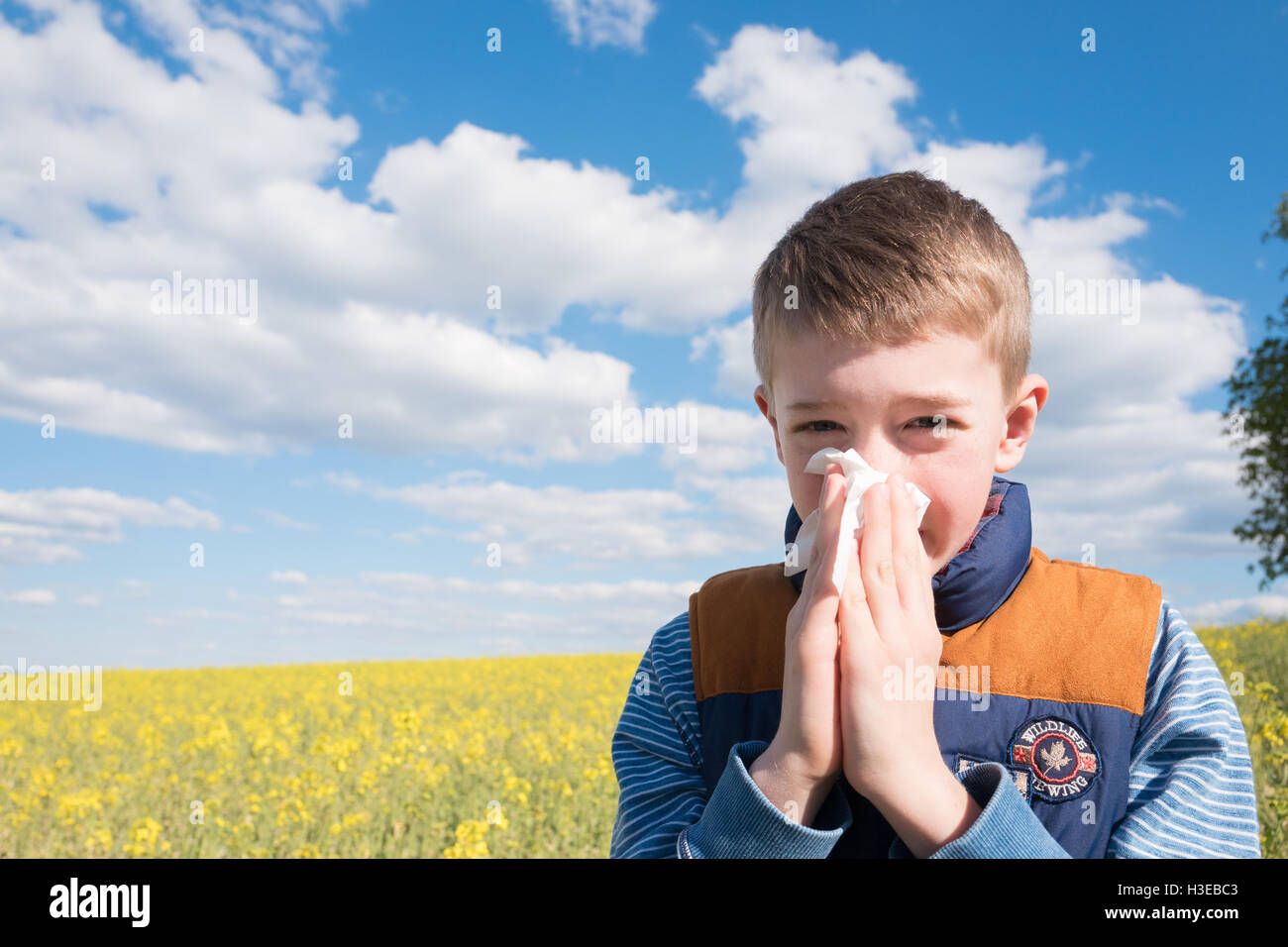 Petit garçon dans champ de canola jaune soufflé son nez et souffrant d'une allergie au pollen. Banque D'Images