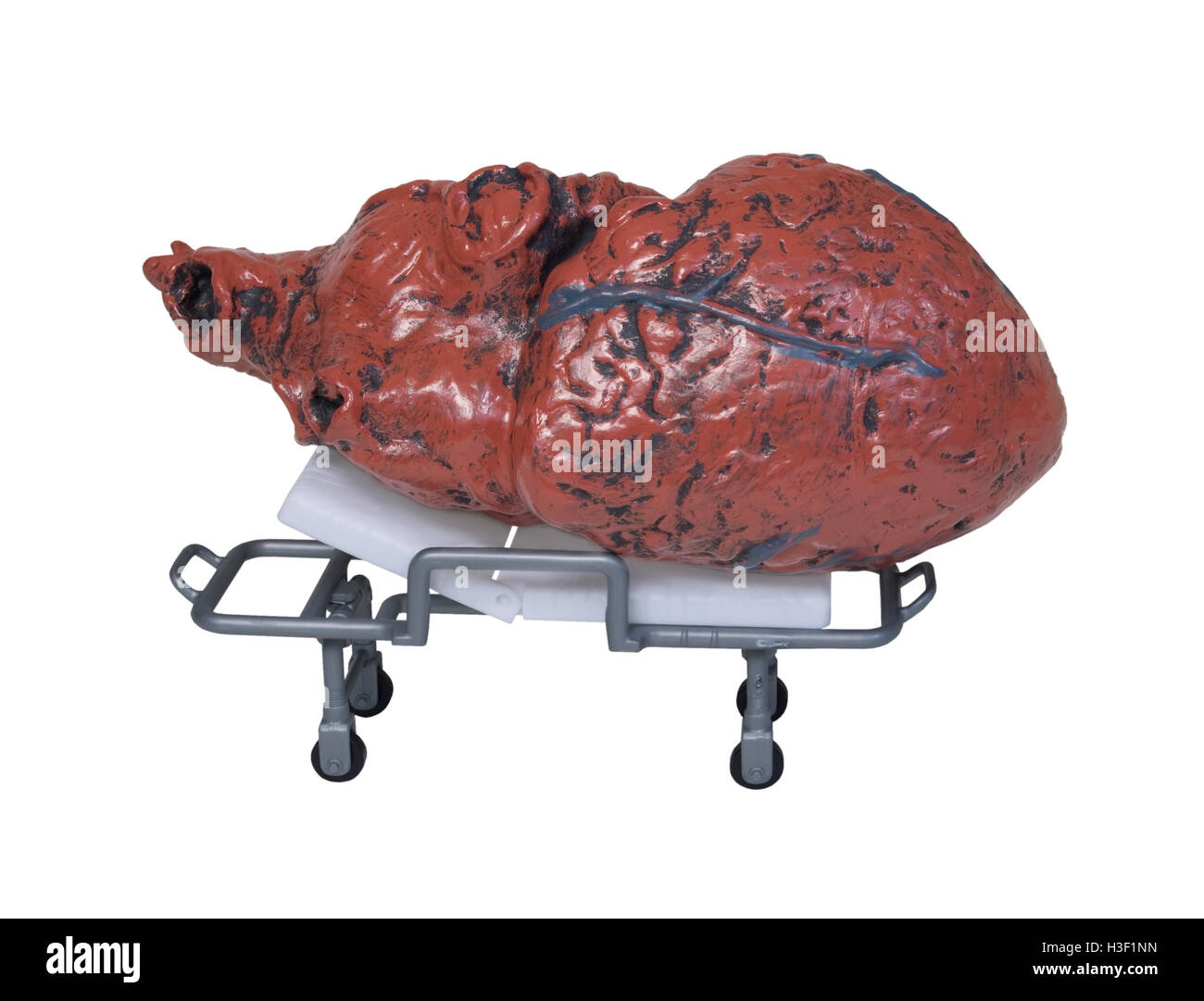 Medical Cœur sur une civière à l'hôpital utilisé pour le transport des patients entre les lieux - chemin inclus Banque D'Images