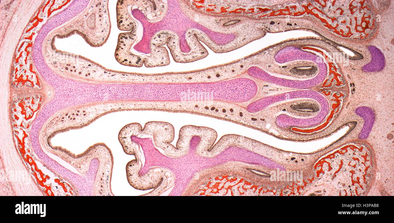 Les sinus nasaux. La lumière microphotographie (LM) des sinus nasaux ( bordée par un épithélium marron ) et les cartilages (rose). Le tissu osseux est identifié par la la moelle rouge. Grossissement : x4 lors de l'impression à 10 centimètres de large. Banque D'Images