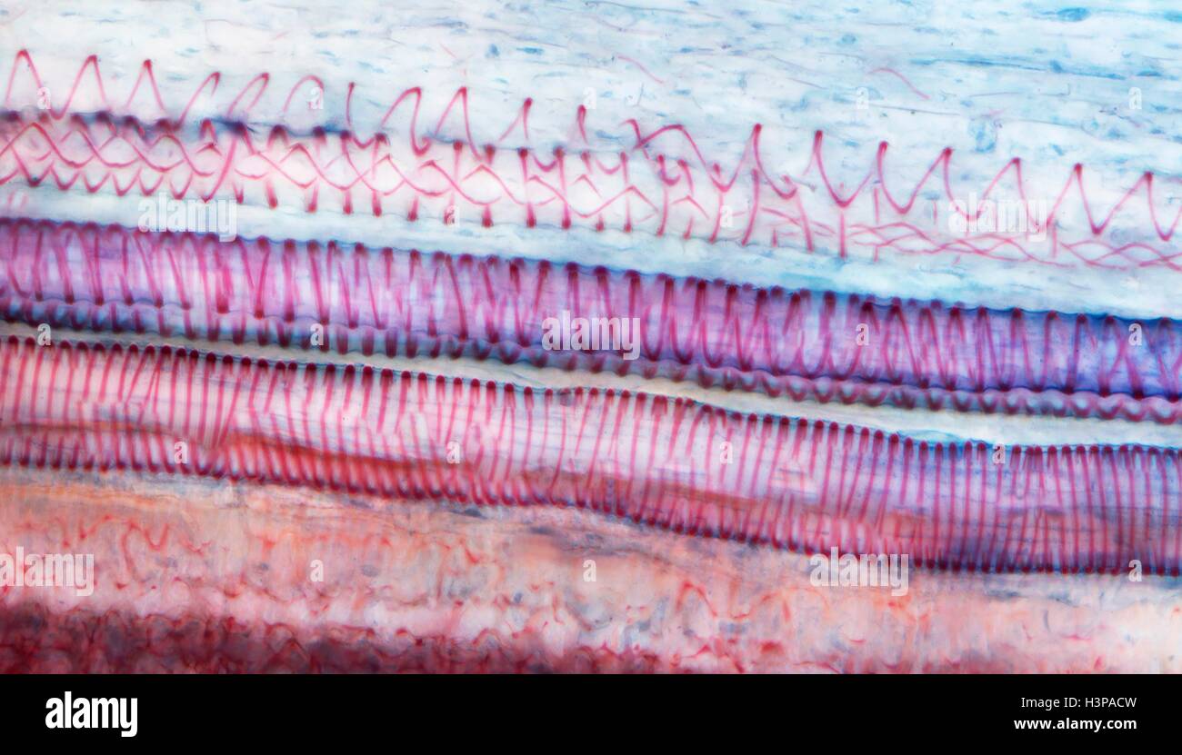 Le xylème. La lumière microphotographie (LM) d'une section à travers le tournesol (helianthus annuus) montrant des tissus, un type trachéides spirale de xylem. Les trachéides sont longues cellules tubulaires avec de la lignine, un matériau qui offre des services de soutien, dans les parois cellulaires. Épaississement spirale des cellules peut être vu. L'eau de conduite les trachéides les racines d'une plante le long des tiges aux feuilles. Agrandissement : x210 lors de l'impression de 10 cm de largeur. Banque D'Images