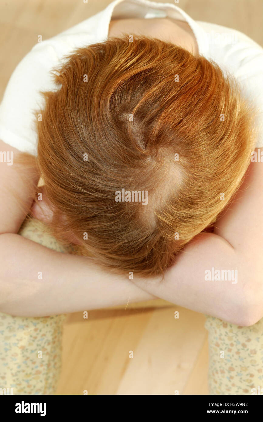 Les filles, l'alopécie, l'enfant, 4 ans, de la maladie, allergie, manifestation mangle, nutrition, faux, faux, nutrition substance minérale mangle, pénurie, l'hypovitaminose, perturbation du métabolisme, maladies immunitaires, les maladies auto-immunes, les cheveux, la tête, le cuir chevelu, alopécie circulaire, pelade, Pelade Banque D'Images