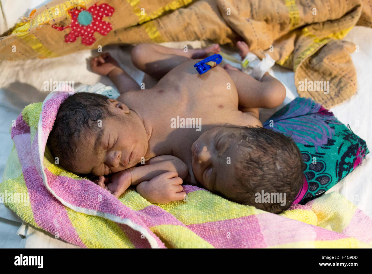 Dhaka, Bangladesh. 15 octobre, 2016. Les parents auraient abandonné les jumeaux siamois au Dhaka Medical College Hospital à Dhaka, Bangladesh, le 15 octobre 2016. DMCH (Dhaka Medical College Hospital) Directeur adjoint Khaja Abdul Gafursaid, 'Les enfants, avec deux têtes, quatre mains et deux jambes, sont nés dans une clinique inconnue à Dhaka et ont été prises pour l'DMCH vendredi soir. Plus tard, leurs parents ont fui en laissant les jumeaux à l'enfant ward." Crédit : zakir Hossain Chowdhury zakir/Alamy Live News Banque D'Images