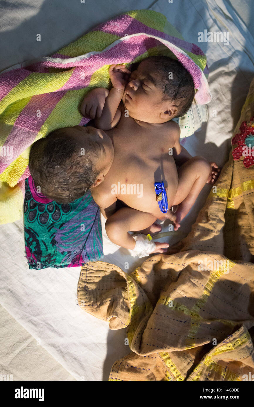 Dhaka, Bangladesh. 15 octobre, 2016. Les parents auraient abandonné les jumeaux siamois au Dhaka Medical College Hospital à Dhaka, Bangladesh, le 15 octobre 2016. DMCH (Dhaka Medical College Hospital) Directeur adjoint Khaja Abdul Gafursaid, 'Les enfants, avec deux têtes, quatre mains et deux jambes, sont nés dans une clinique inconnue à Dhaka et ont été prises pour l'DMCH vendredi soir. Plus tard, leurs parents ont fui en laissant les jumeaux à l'enfant ward." Crédit : zakir Hossain Chowdhury zakir/Alamy Live News Banque D'Images