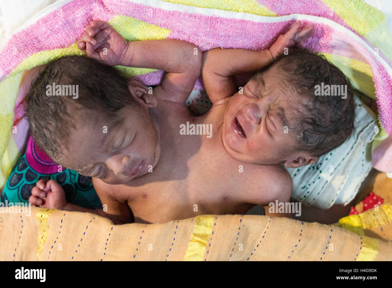 Dhaka, Bangladesh. 15 octobre, 2016. Les parents auraient abandonné les jumeaux siamois au Dhaka Medical College Hospital à Dhaka, Bangladesh, le 15 octobre 2016. DMCH (Dhaka Medical College Hospital) Directeur adjoint Khaja Abdul Gafursaid, 'Les enfants, avec deux têtes, quatre mains et deux jambes, sont nés dans une clinique inconnue à Dhaka et ont été prises pour l'DMCH vendredi soir. Plus tard, leurs parents ont fui en laissant les jumeaux à l'enfant ward." Crédit : zakir Hossain Chowdhury zakir/Alamy Live News Banque D'Images