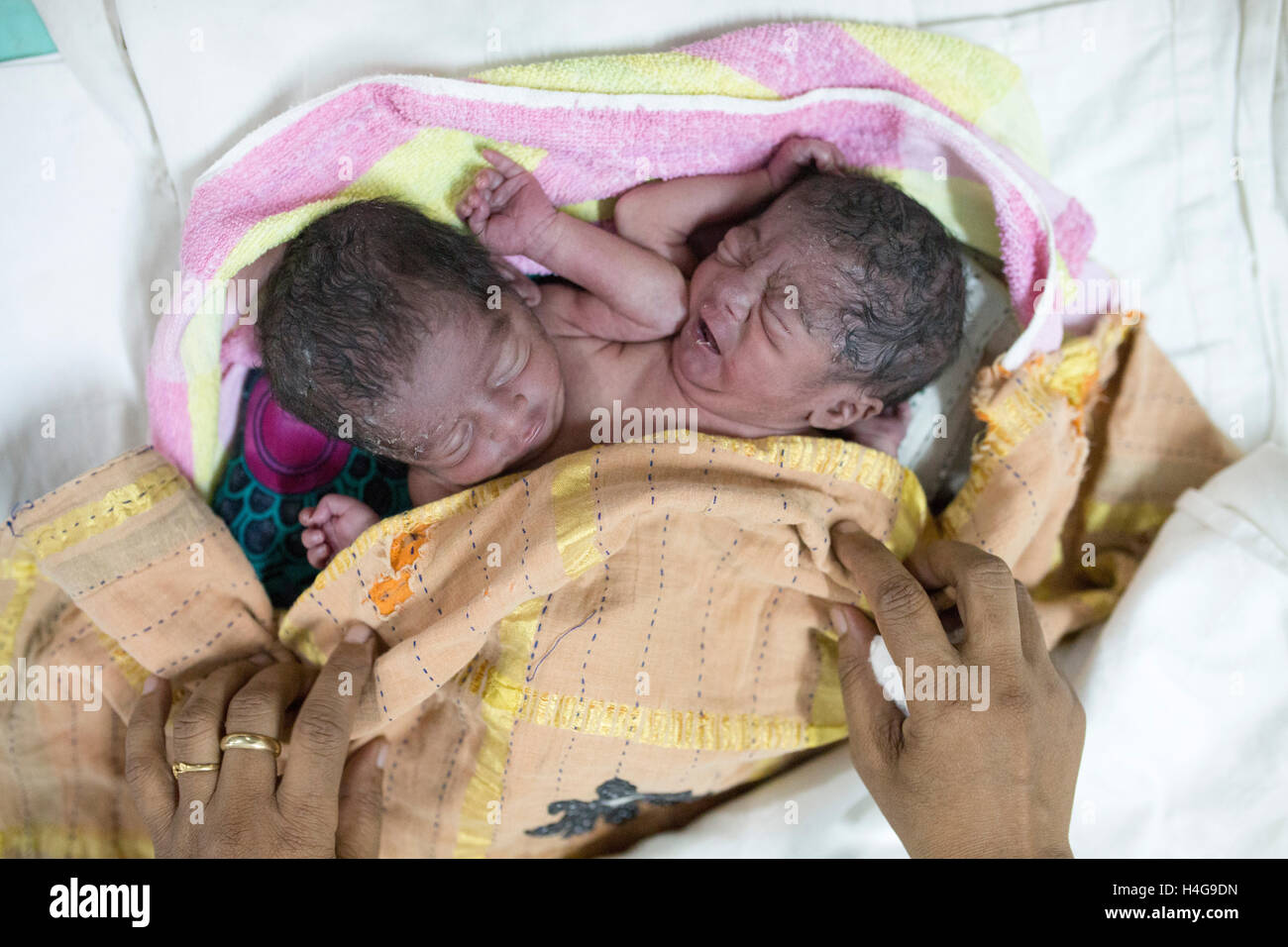 Dhaka, Bangladesh. 15 octobre, 2016. Les parents auraient abandonné les jumeaux siamois au Dhaka Medical College Hospital à Dhaka, Bangladesh, le 15 octobre 2016. DMCH (Dhaka Medical College Hospital) Directeur adjoint Khaja Abdul Gafursaid, 'Les enfants, avec deux têtes, quatre mains et deux jambes, sont nés dans une clinique inconnue à Dhaka et ont été prises pour l'DMCH vendredi soir. Plus tard, leurs parents ont fui en laissant les jumeaux à l'enfant ward." Crédit : zakir Hossain Chowdhury zakir/Alamy Live News Banque D'Images