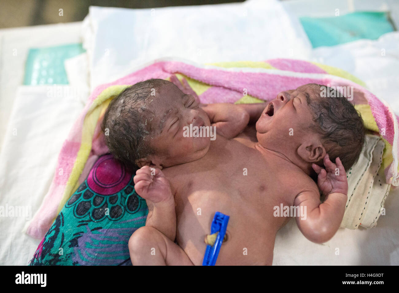 Dhaka, Bangladesh. 15 octobre, 2016. Les parents auraient abandonné les jumeaux siamois au Dhaka Medical College Hospital à Dhaka, Bangladesh, le 15 octobre 2016. DMCH (Dhaka Medical College Hospital) Directeur adjoint Khaja Abdul Gafursaid, 'Les enfants, avec deux têtes, quatre mains et deux jambes, sont nés dans une clinique inconnue à Dhaka et ont été prises pour l'DMCH vendredi soir. Plus tard, leurs parents ont fui en laissant les jumeaux à l'enfant ward." Crédit : zakir Hossain Chowdhury zakir/Alamy Live News Banque D'Images