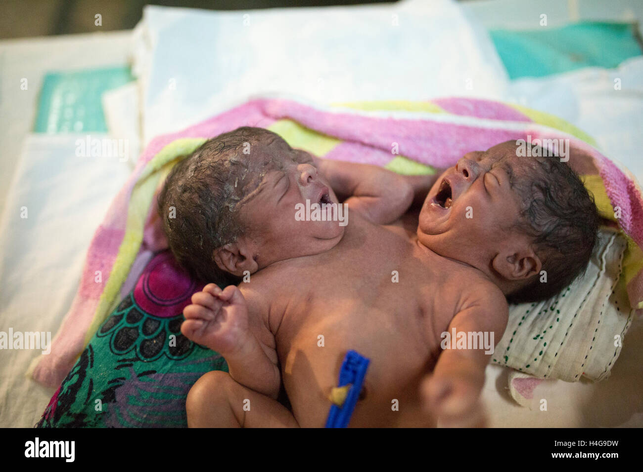 Dhaka, Bangladesh. 15 octobre, 2016. Les parents auraient abandonné les jumeaux siamois au Dhaka Medical College Hospital à Dhaka, Bangladesh, le 15 octobre 2016. DMCH (Dhaka Medical College Hospital) Directeur adjoint Khaja Abdul Gafursaid, 'Les enfants, avec deux têtes, quatre mains et deux jambes, sont nés dans une clinique inconnue à Dhaka et ont été prises pour l'DMCH vendredi soir. Plus tard, leurs parents ont fui en laissant les jumeaux à l'enfant ward." Crédit : zakir Hossain Chowdhury zakir/Alamy Live News Banque D'Images