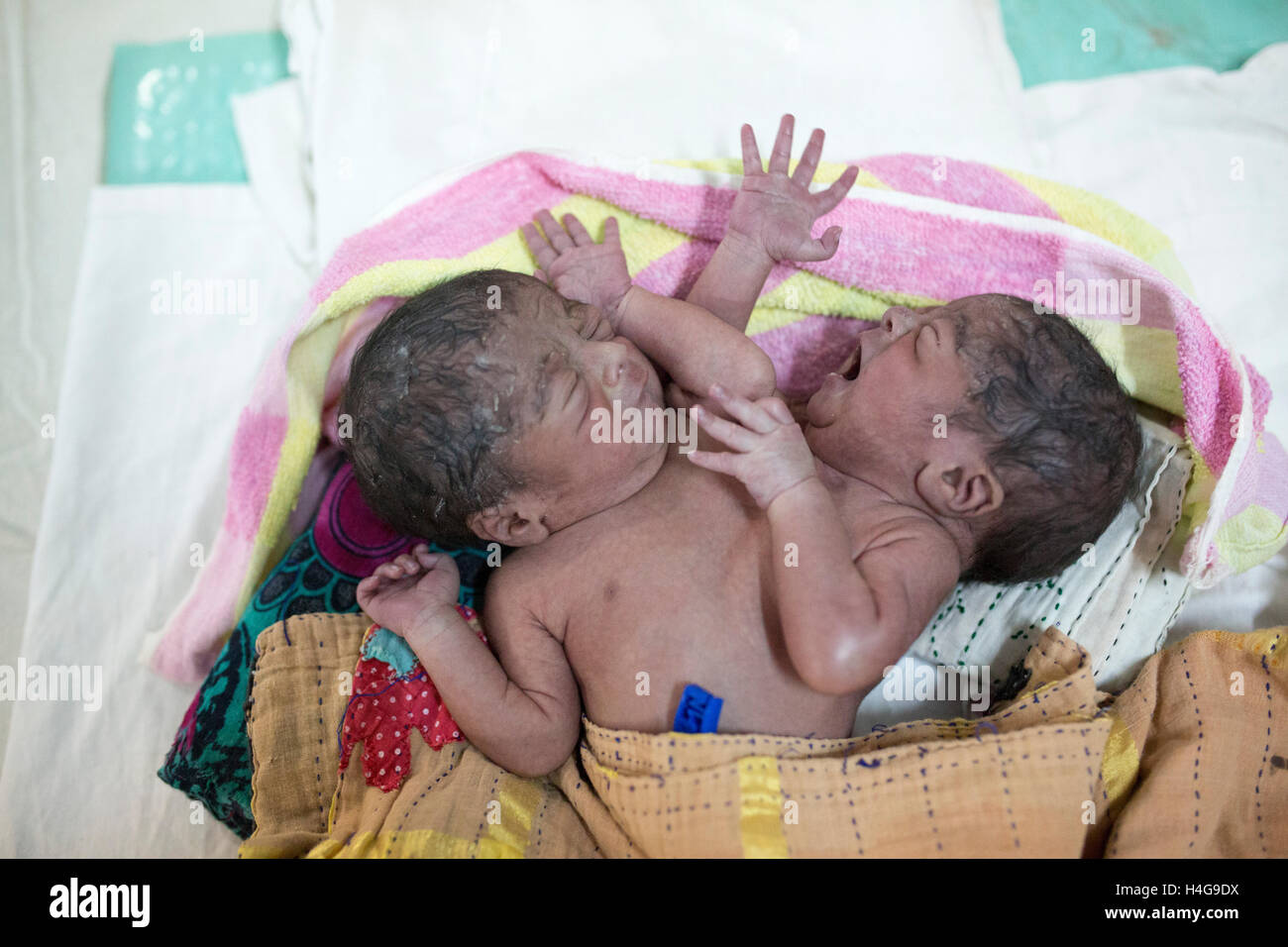 Dhaka, Bangladesh. 15 octobre, 2016. Les parents auraient abandonné les jumeaux siamois au Dhaka Medical College Hospital à Dhaka, Bangladesh, le 15 octobre 2016. DMCH (Dhaka Medical College Hospital) Directeur adjoint Khaja Abdul Gafursaid, 'Les enfants, avec deux têtes, quatre mains et deux jambes, sont nés dans une clinique inconnue à Dhaka et ont été prises pour l'DMCH vendredi soir. Plus tard, leurs parents ont fui en laissant les jumeaux à l'enfant ward." Crédit : zakir Hossain Chowdhury zakir/Alamy Live News Banque D'Images
