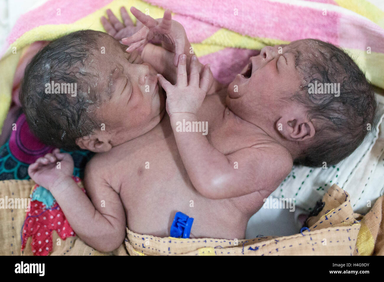 Dhaka, Bangladesh. 15 octobre, 2016. Les parents auraient abandonné les jumeaux siamois au Dhaka Medical College Hospital à Dhaka, Bangladesh, le 15 octobre 2016. DMCH (Dhaka Medical College Hospital) Directeur adjoint Khaja Abdul Gafursaid, 'Les enfants, avec deux têtes, quatre mains et deux jambes, sont nés dans une clinique inconnue à Dhaka et ont été prises pour l'DMCH vendredi soir. Plus tard, leurs parents ont fui en laissant les jumeaux à l'enfant ward." Crédit : zakir Hossain Chowdhury zakir/Alamy Live News Banque D'Images