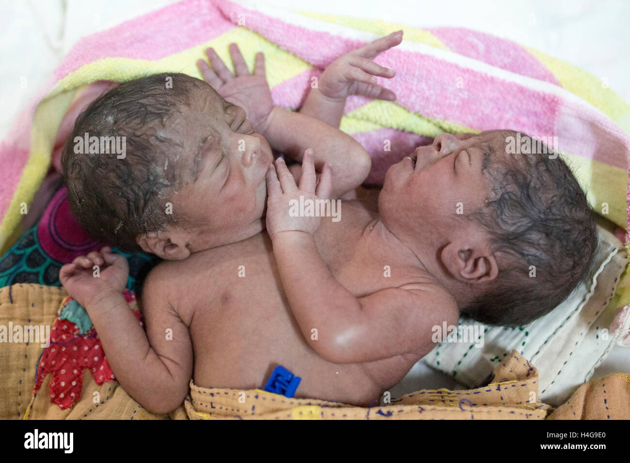 Dhaka, Bangladesh. 15 octobre, 2016. Les parents auraient abandonné les jumeaux siamois au Dhaka Medical College Hospital à Dhaka, Bangladesh, le 15 octobre 2016. DMCH (Dhaka Medical College Hospital) Directeur adjoint Khaja Abdul Gafursaid, 'Les enfants, avec deux têtes, quatre mains et deux jambes, sont nés dans une clinique inconnue à Dhaka et ont été prises pour l'DMCH vendredi soir. Plus tard, leurs parents ont fui en laissant les jumeaux à l'enfant ward." Crédit : zakir Hossain Chowdhury zakir/Alamy Live News Banque D'Images