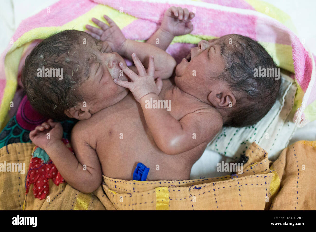 Dhaka, Bangladesh. 15 octobre, 2016. Les parents auraient abandonné les jumeaux siamois au Dhaka Medical College Hospital à Dhaka, Bangladesh, le 15 octobre 2016. DMCH (Dhaka Medical College Hospital) Directeur adjoint Khaja Abdul Gafursaid, 'Les enfants, avec deux têtes, quatre mains et deux jambes, sont nés dans une clinique inconnue à Dhaka et ont été prises pour l'DMCH vendredi soir. Plus tard, leurs parents ont fui en laissant les jumeaux à l'enfant ward." Crédit : zakir Hossain Chowdhury zakir/Alamy Live News Banque D'Images