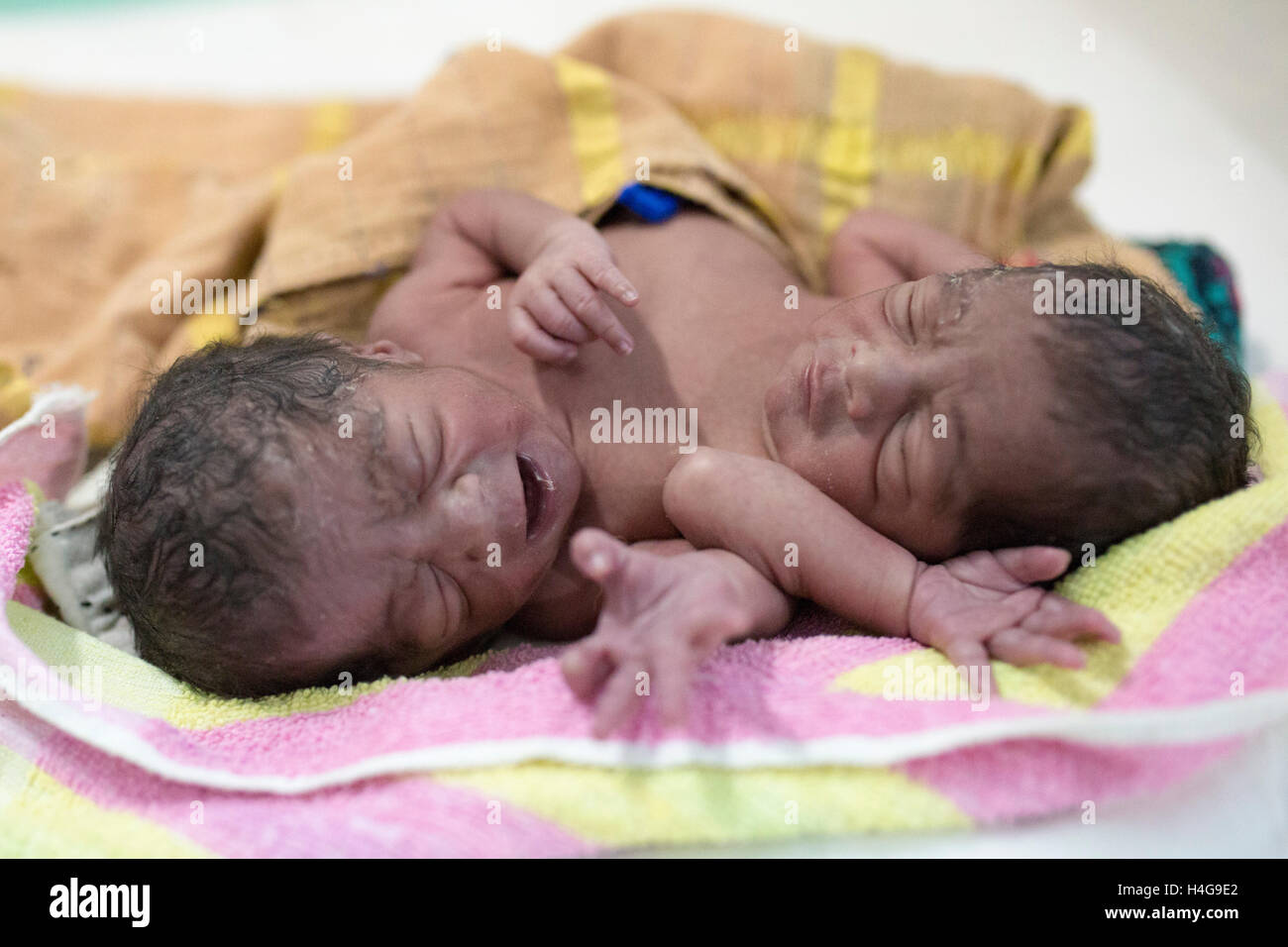 Dhaka, Bangladesh. 15 octobre, 2016. Les parents auraient abandonné les jumeaux siamois au Dhaka Medical College Hospital à Dhaka, Bangladesh, le 15 octobre 2016. DMCH (Dhaka Medical College Hospital) Directeur adjoint Khaja Abdul Gafursaid, 'Les enfants, avec deux têtes, quatre mains et deux jambes, sont nés dans une clinique inconnue à Dhaka et ont été prises pour l'DMCH vendredi soir. Plus tard, leurs parents ont fui en laissant les jumeaux à l'enfant ward." Crédit : zakir Hossain Chowdhury zakir/Alamy Live News Banque D'Images