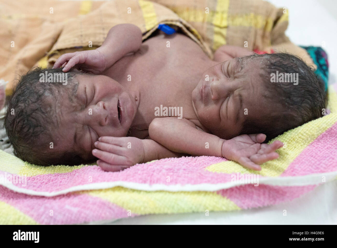 Dhaka, Bangladesh. 15 octobre, 2016. Les parents auraient abandonné les jumeaux siamois au Dhaka Medical College Hospital à Dhaka, Bangladesh, le 15 octobre 2016. DMCH (Dhaka Medical College Hospital) Directeur adjoint Khaja Abdul Gafursaid, 'Les enfants, avec deux têtes, quatre mains et deux jambes, sont nés dans une clinique inconnue à Dhaka et ont été prises pour l'DMCH vendredi soir. Plus tard, leurs parents ont fui en laissant les jumeaux à l'enfant ward." Crédit : zakir Hossain Chowdhury zakir/Alamy Live News Banque D'Images