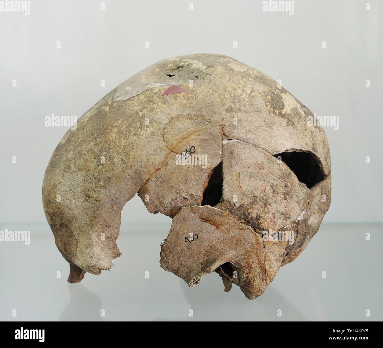 La Pologne. La préhistoire. Crâne humain avec une trace du coup avec un instrument contondant. Elle est présentée dans une exposition permanente "maladie de la population préhistorique en terre polonaise". Musée archéologique. Gdansk. La Pologne. Banque D'Images