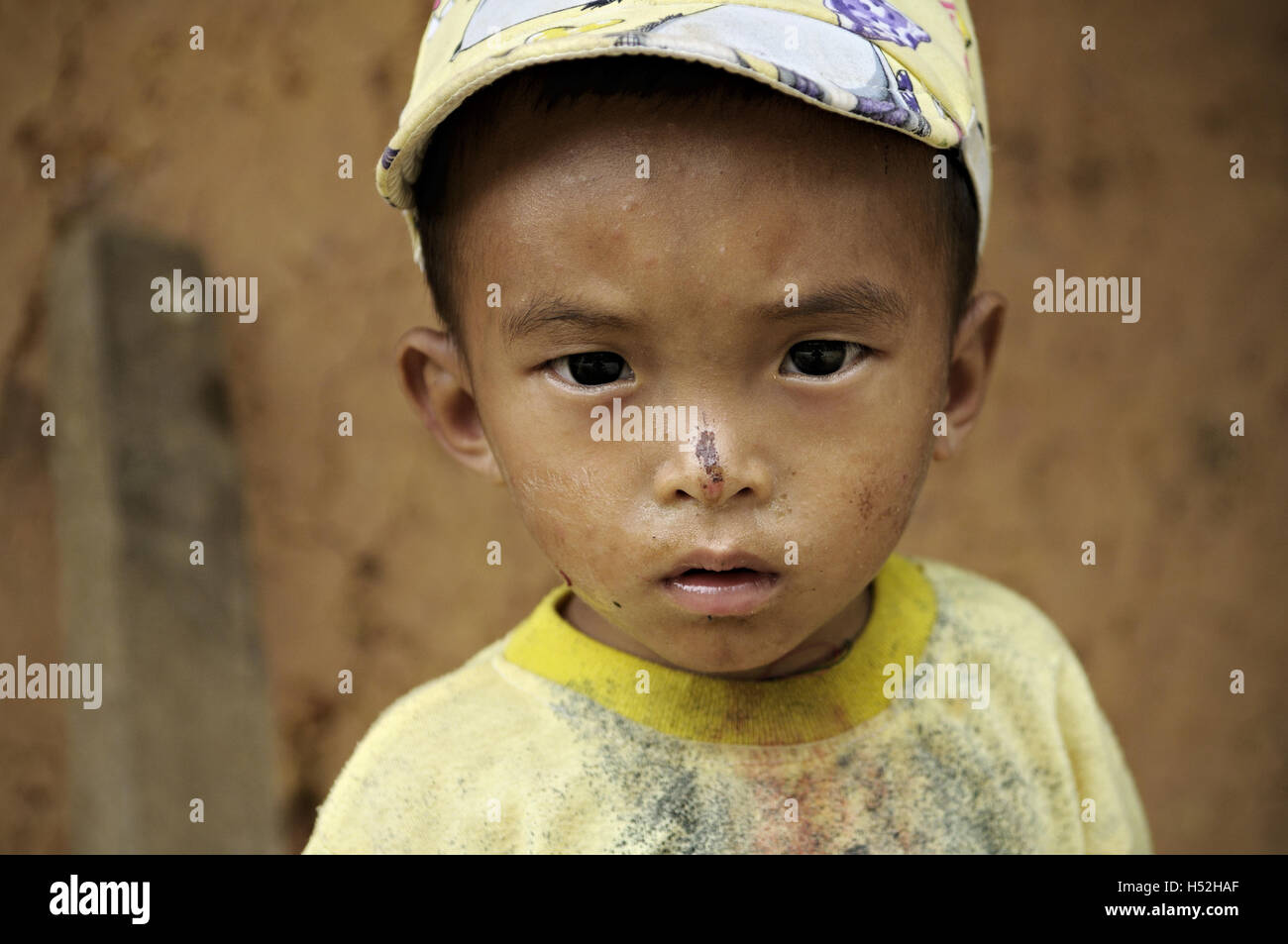 Petit garçon avec un chapeau et se gratta le nez dans la province de Ha Giang, Vietnam du Nord Banque D'Images