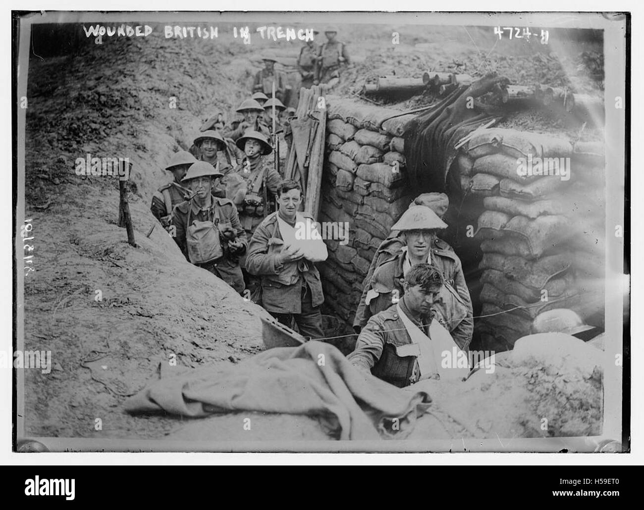 Photographie ou référence représentant des soldats britanniques blessés, peut-être à la suite d'un conflit ou d'une guerre, mettant en évidence l'impact de la bataille sur les individus. Banque D'Images
