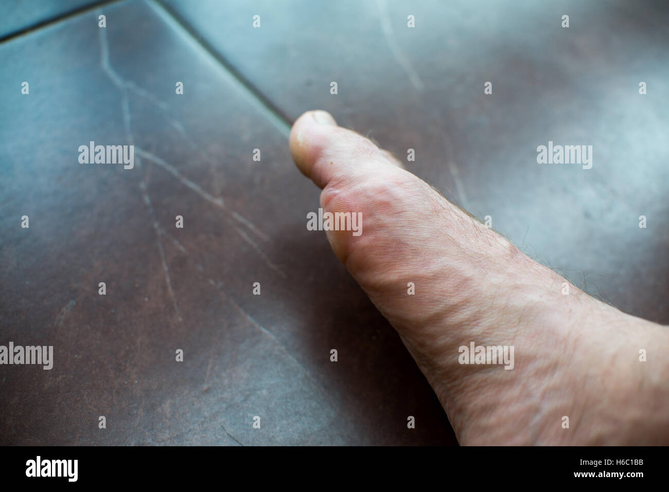 Close up sur ampoule sur pied d'un homme Banque D'Images