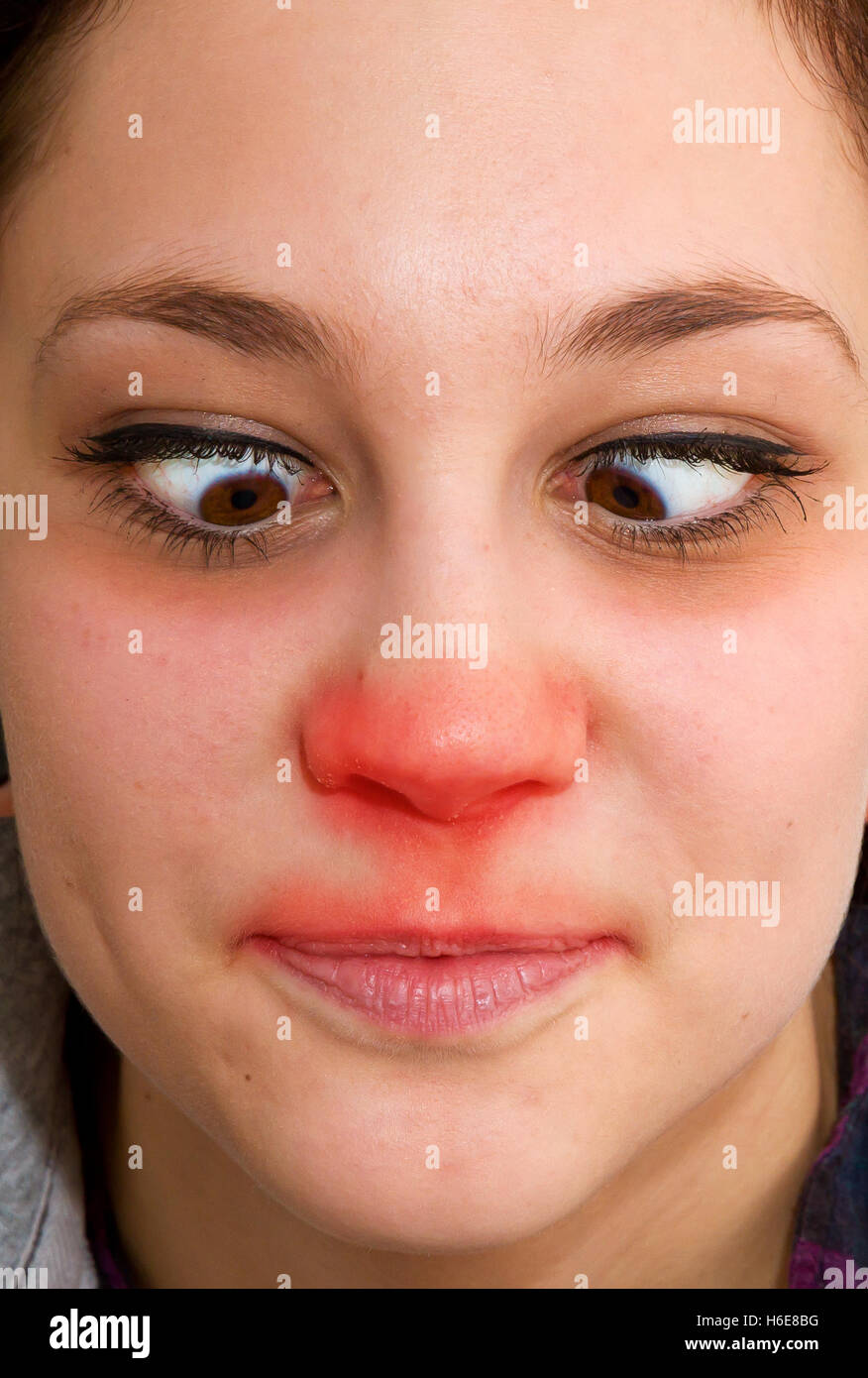 Jeune femme avec un nez rouge et froide Banque D'Images