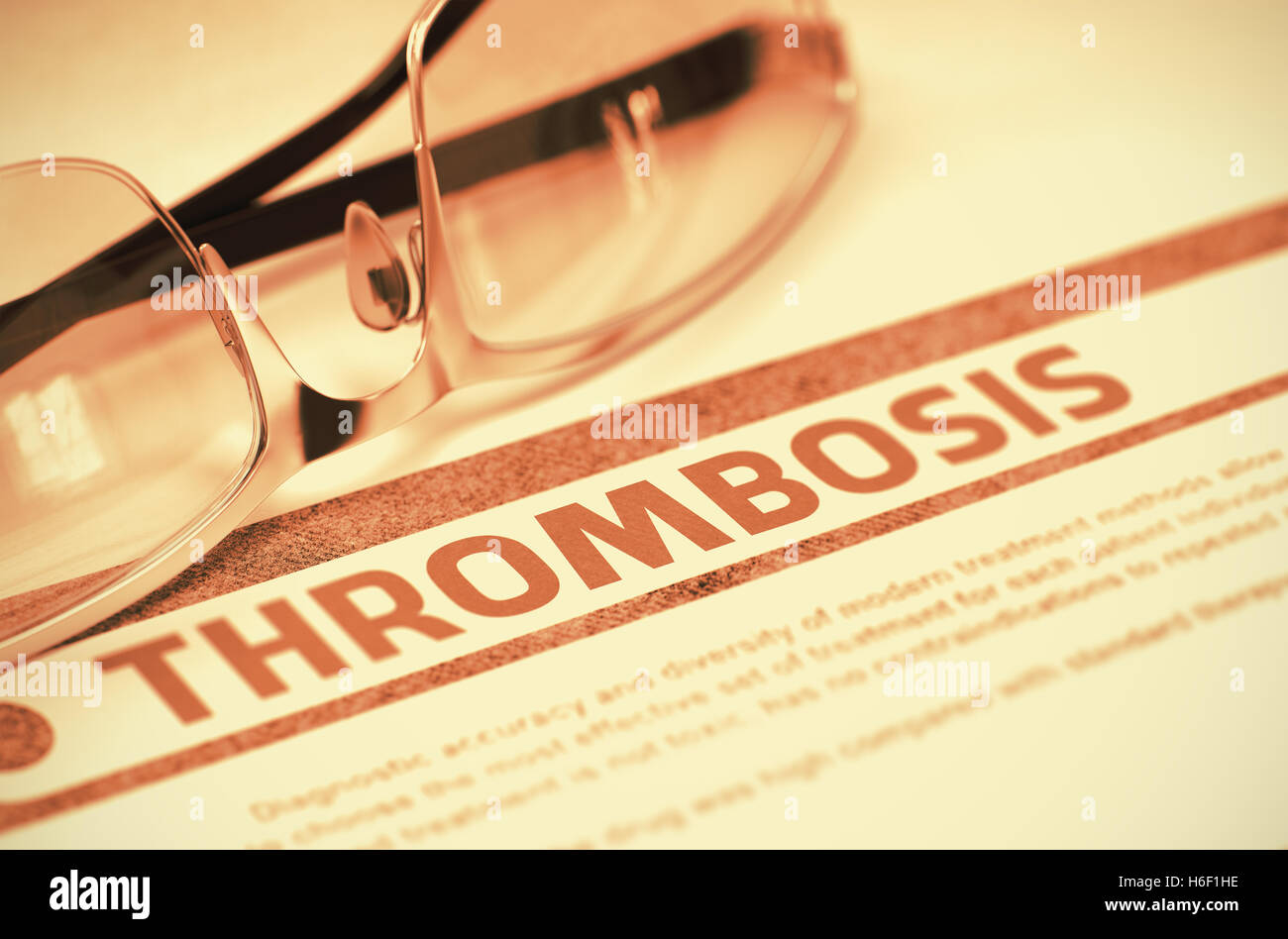 Le diagnostic - Thrombose. Concept médical. 3D Illustration. Banque D'Images