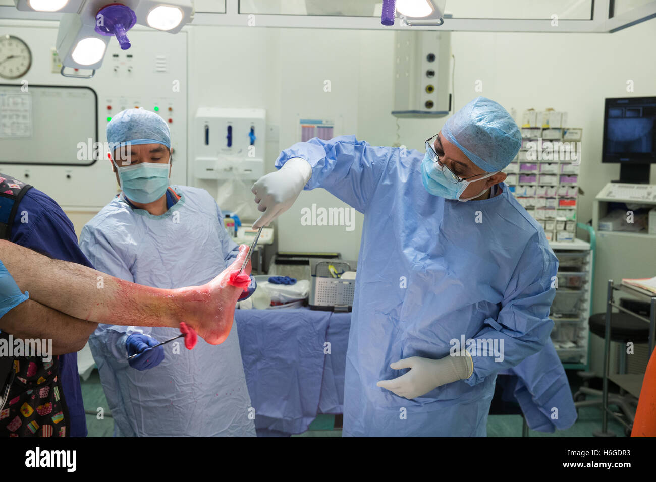 Un chirurgien et le personnel de préparer un patient pour l'intervention avant de procéder à une réduction ouverte et d'une fixation interne de la cheville gauche Banque D'Images