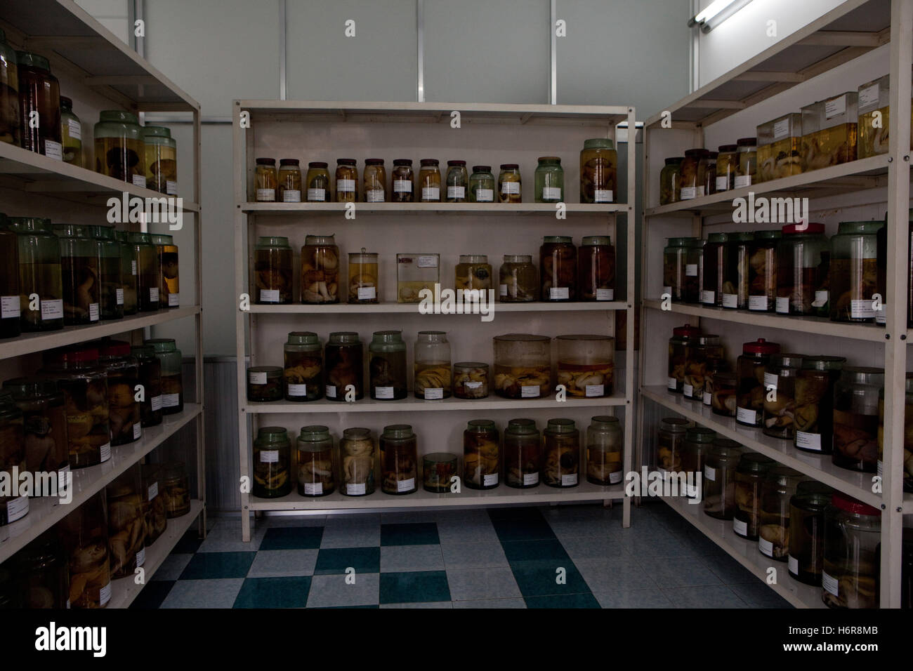 Bols de fœtus présentant des défauts de l'exposition à la dioxine de l'agent Orange utilisé durant la guerre du Vietnam, Tu Do Hospital Ho Chi Minh city Banque D'Images