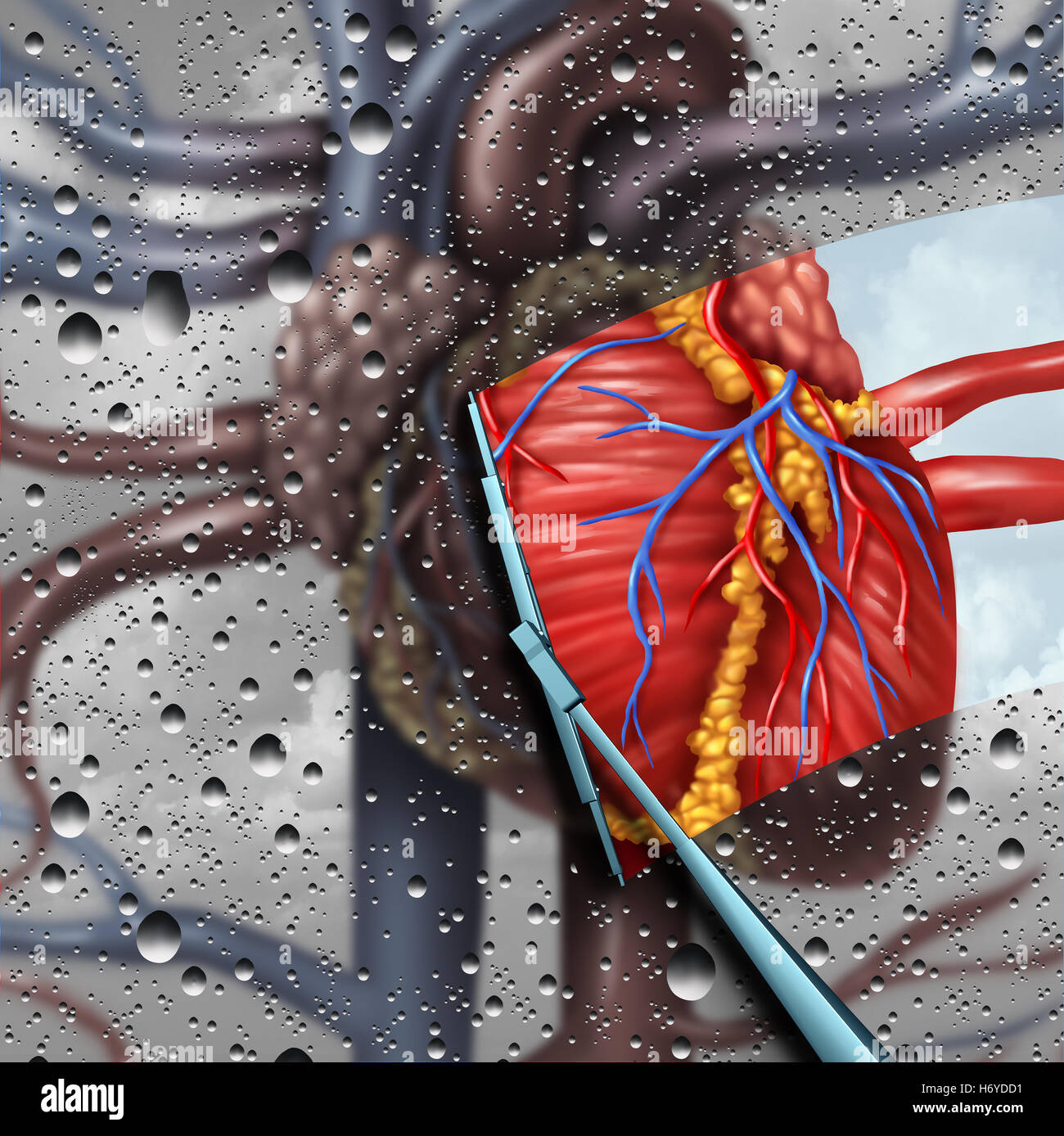 Les maladies du cœur humain comme une thérapie de la santé cardiaque et cardiovasculaire concept médical avec un balais d'essuyer et retrait d'un malade en cure d'organes floue et symbole de traitement ou le chirurgien cardiologue avec 3D illustration éléments. Banque D'Images
