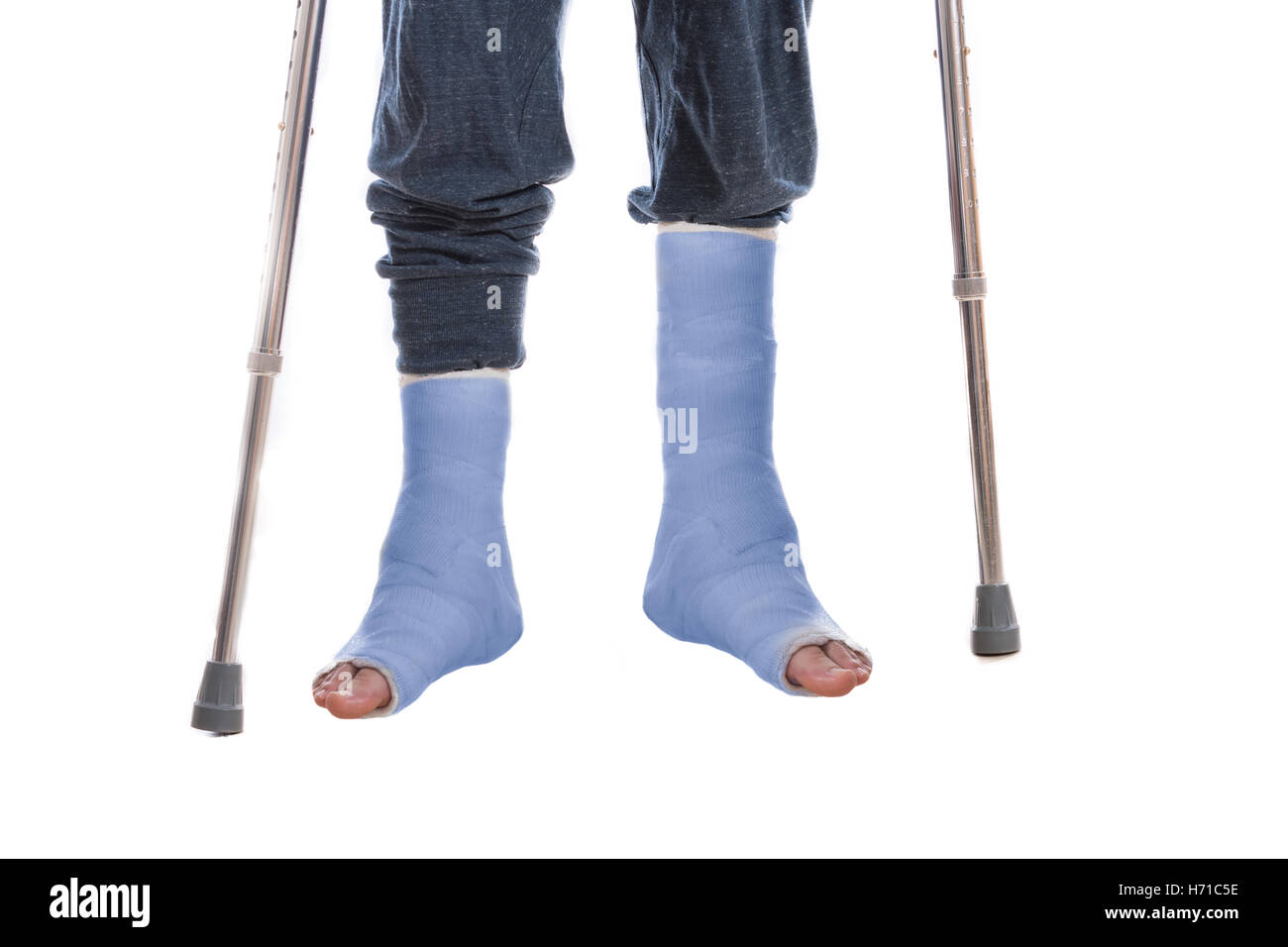 Jeune homme avec deux chevilles cassées et double blue jette sur ses jambes, s'appuyant sur des béquilles (isolé sur blanc) Banque D'Images