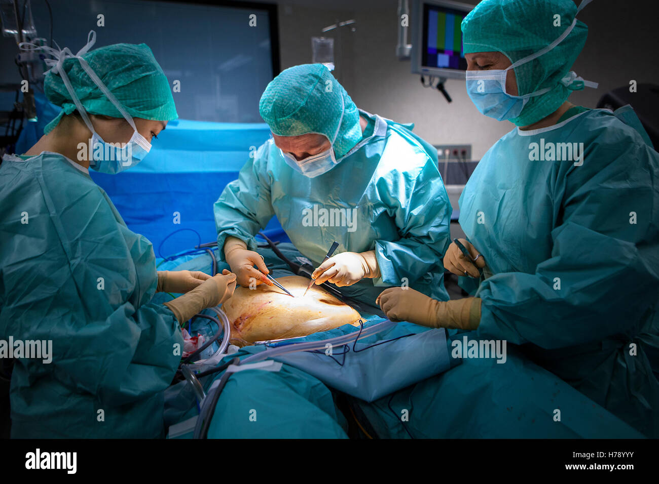 La chirurgie assistée par robot Banque D'Images