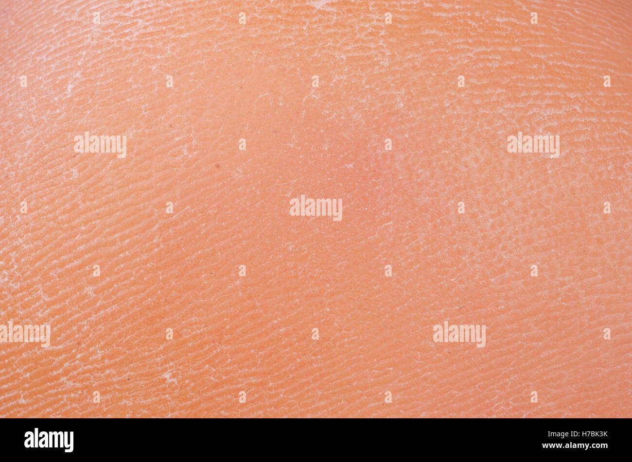 Jambe peau sèche et rugueuse Banque de photographies et d’images à haute résolution Alamy