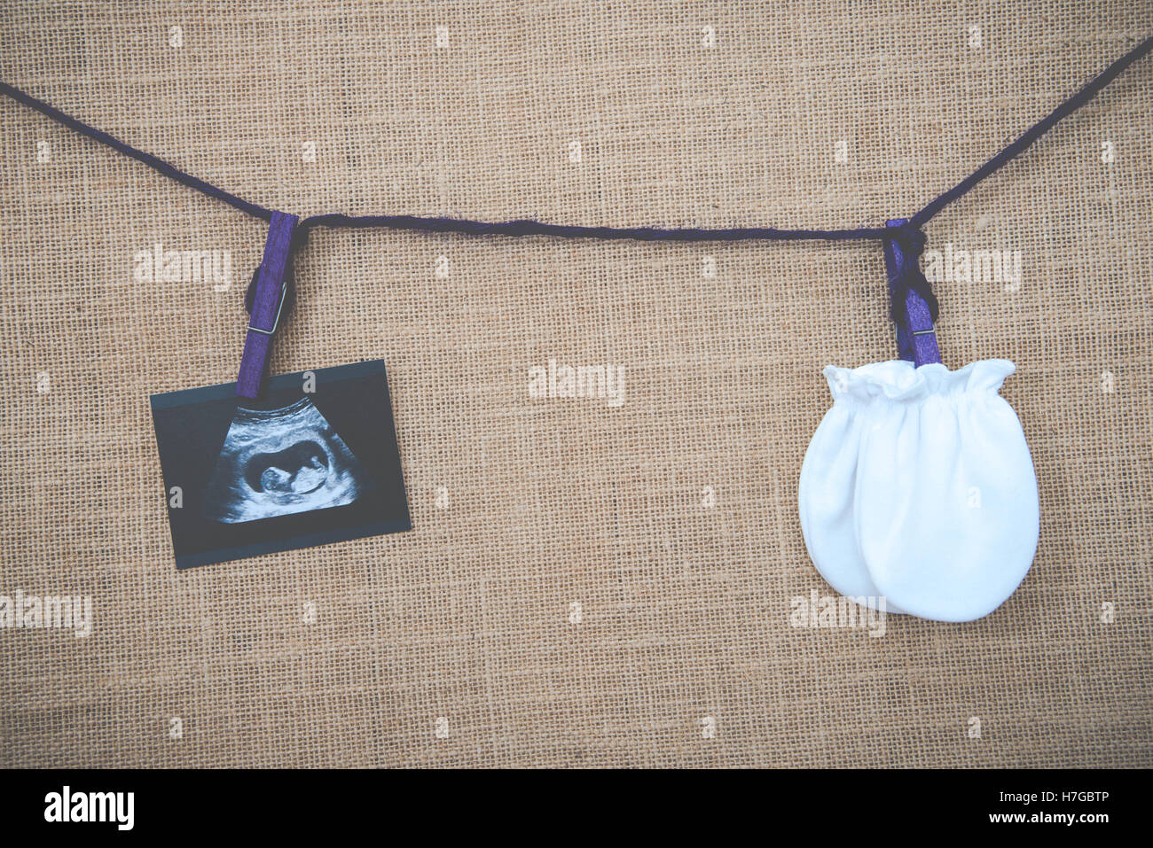 Collage D Images Medicales De L Echographie Pendant La Grossesse Femme Montrant Foetus Dans Le Troisieme Mois Et Gants De Sacs Bebe Backgrou Photo Stock Alamy Collage D Images Medicales De L Echographie Pendant La Grossesse Femme Montrant Foetus Dans Le Troisieme Mois Et Gants De Sacs Bebe Backgrou Photo Stock Alamy