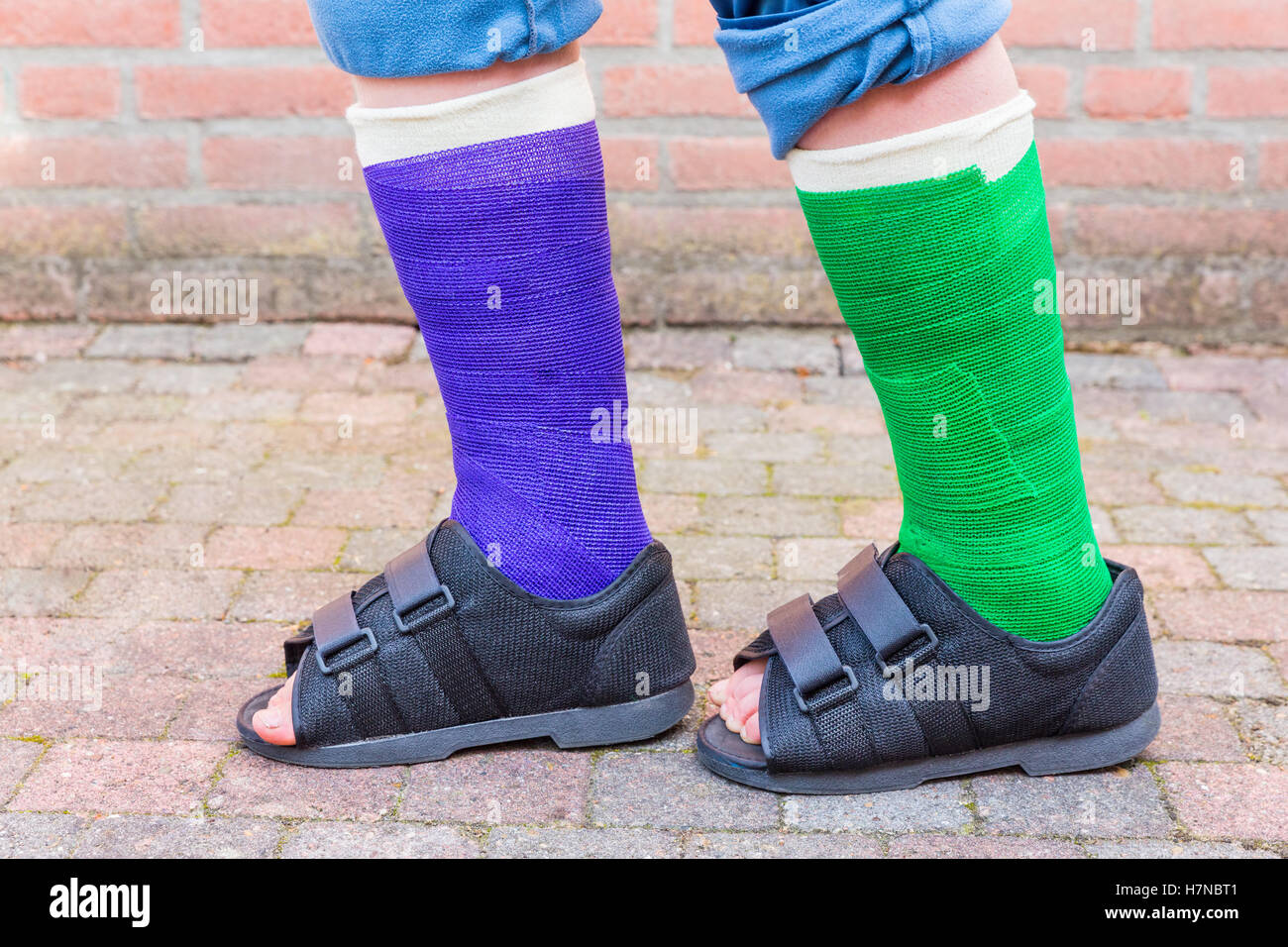 L'article teenage boy avec deux jambes de gypse de couleur à l'extérieur Banque D'Images