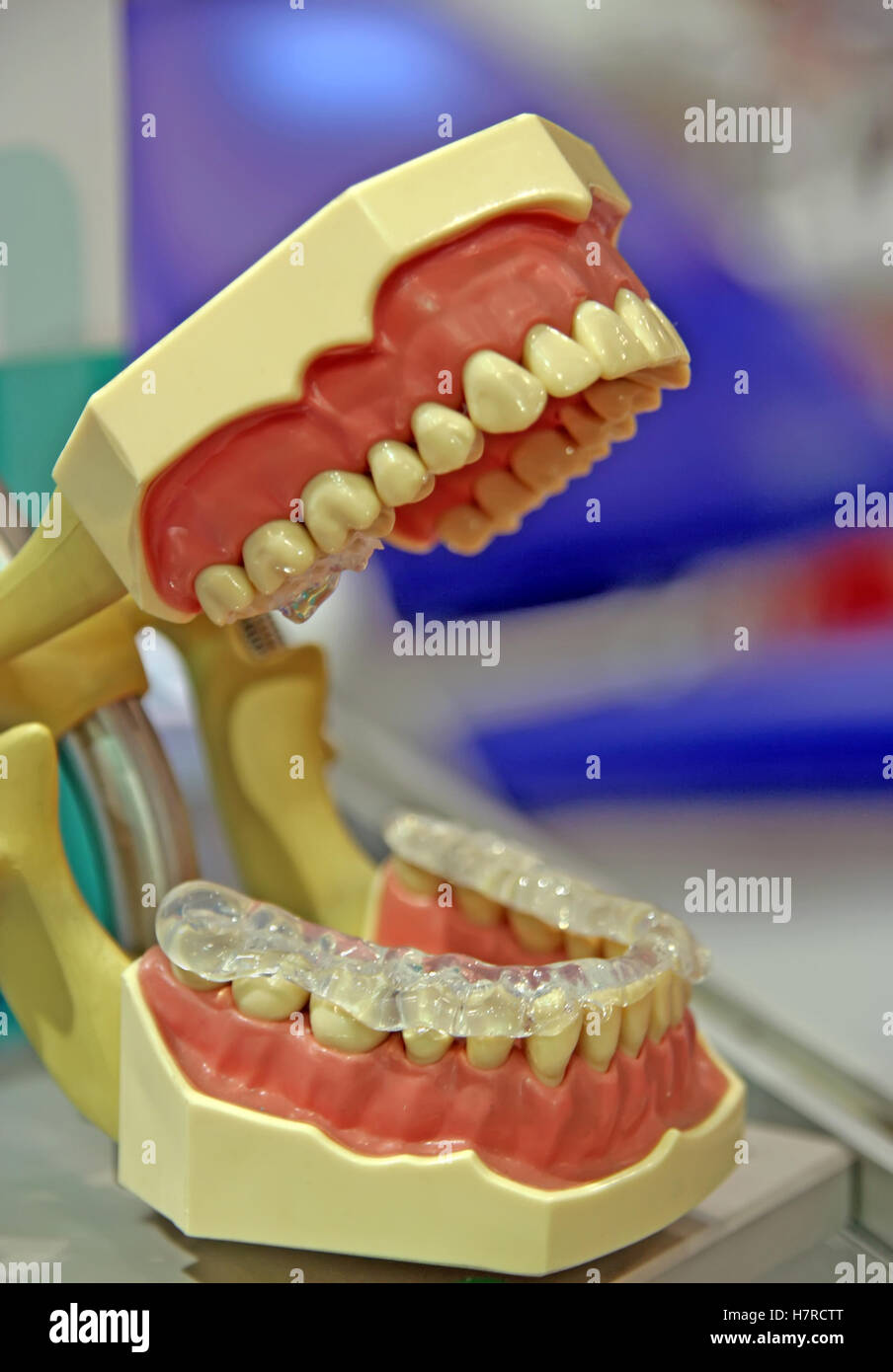 Les dents artificielles. Mâchoire humaine prothétiques. Banque D'Images
