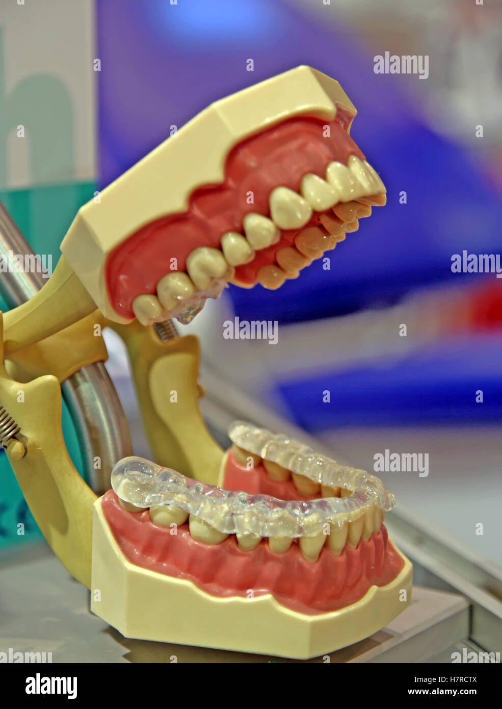 Les dents artificielles. Mâchoire humaine prothétiques. Banque D'Images