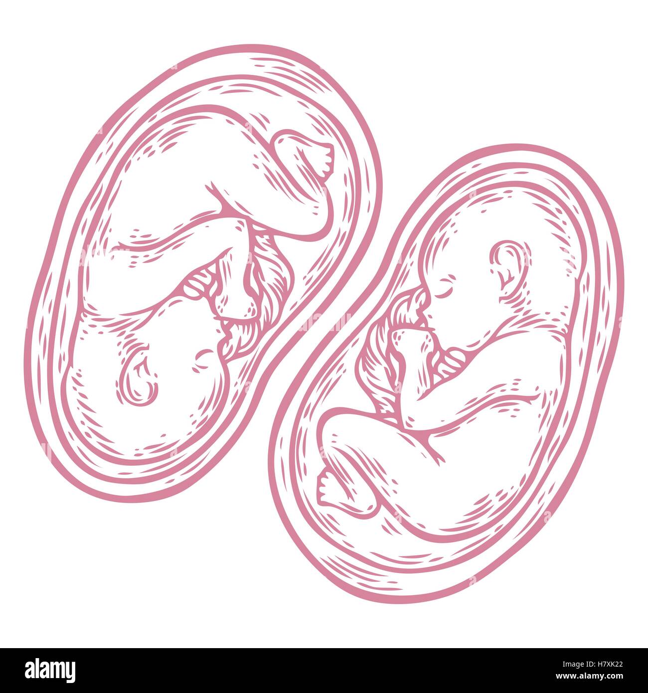 Les jumeaux foetus concept hand drawn vector illustration bébé en croissance prénatale, umbilicle épinière isolé sur un fond blanc. Illustration de Vecteur