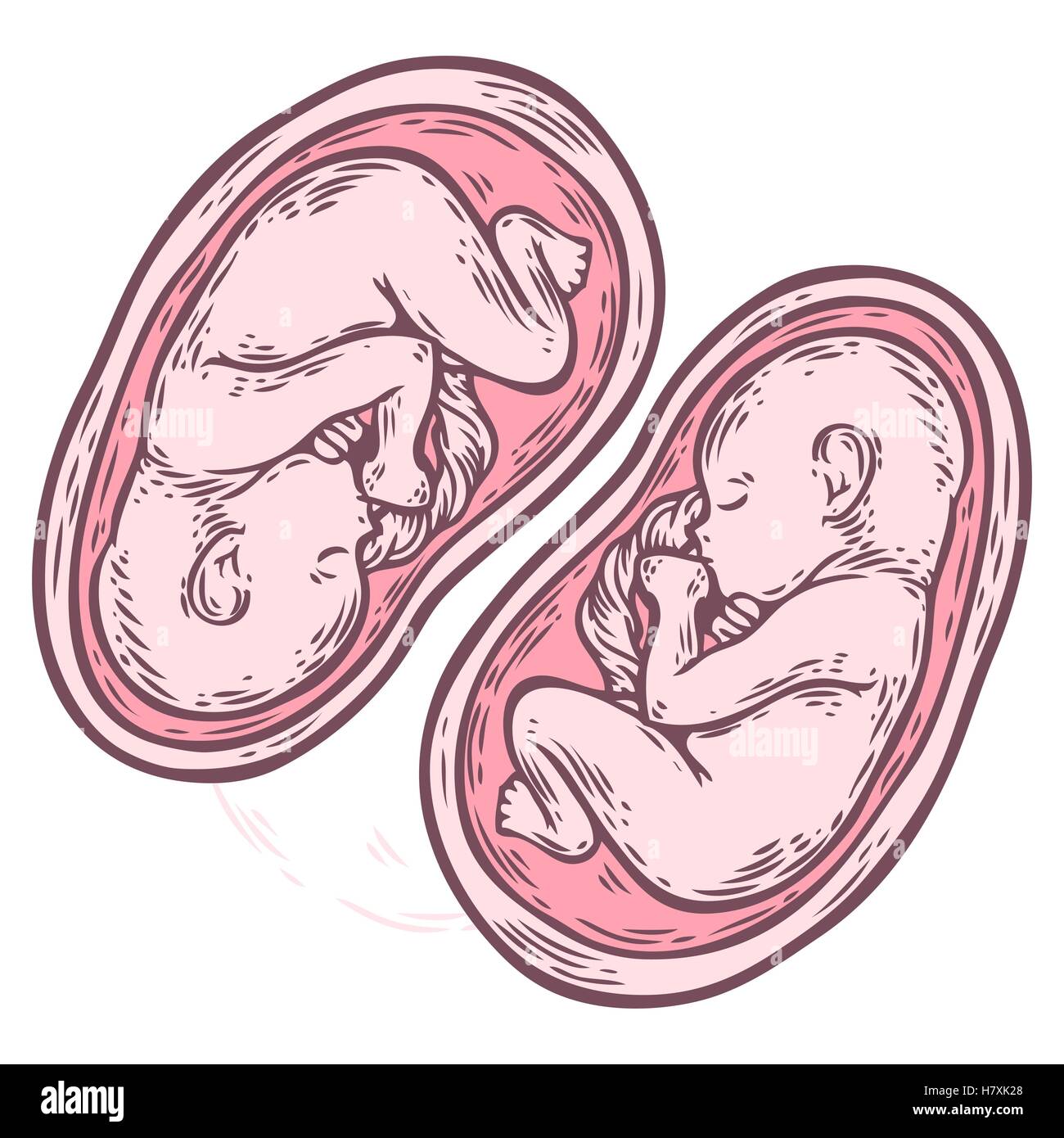 Les jumeaux foetus concept hand drawn vector illustration bébé en croissance prénatale, umbilicle épinière isolé sur un fond blanc. Illustration de Vecteur